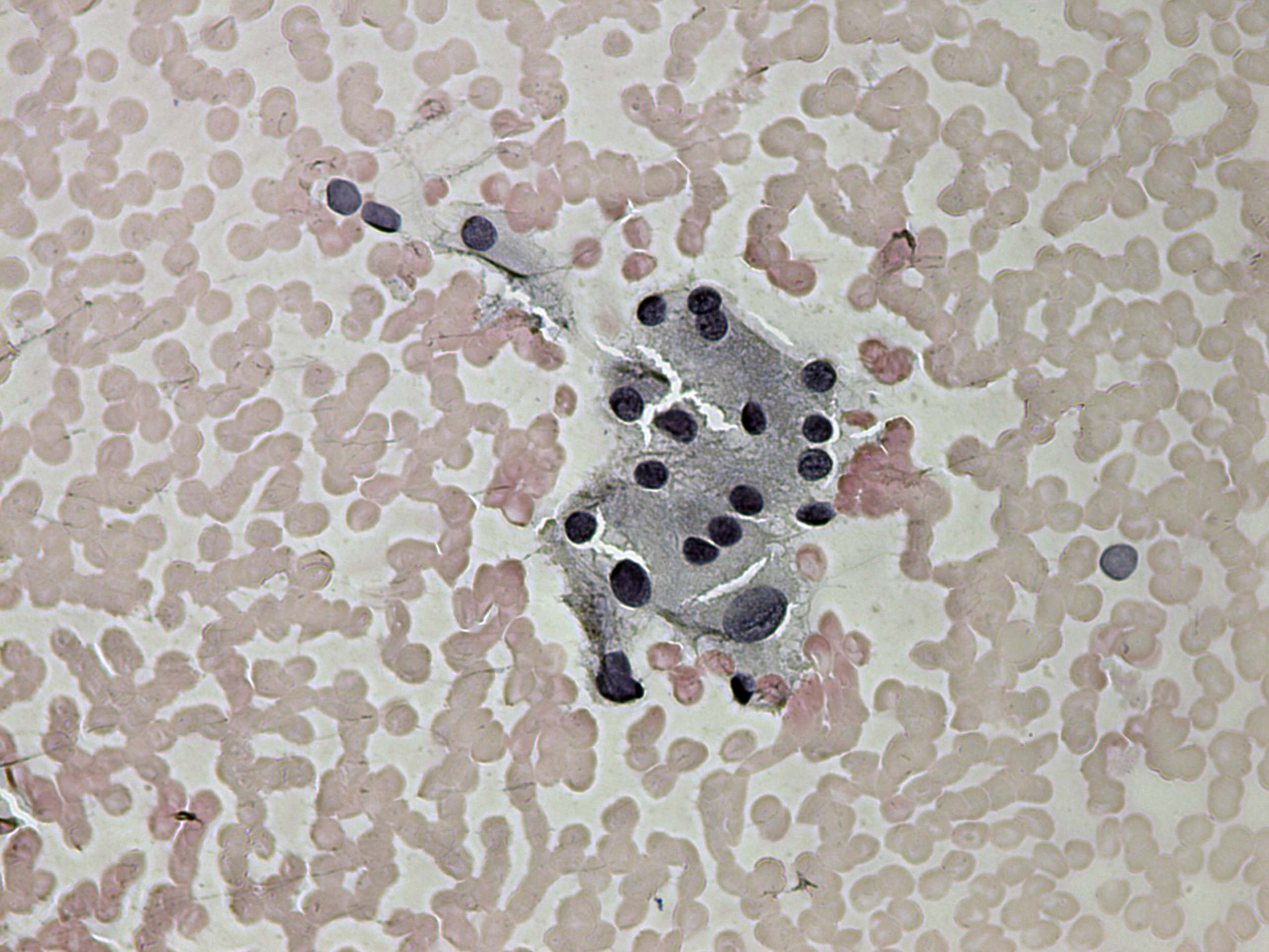 Right lobe, longitudinal scan