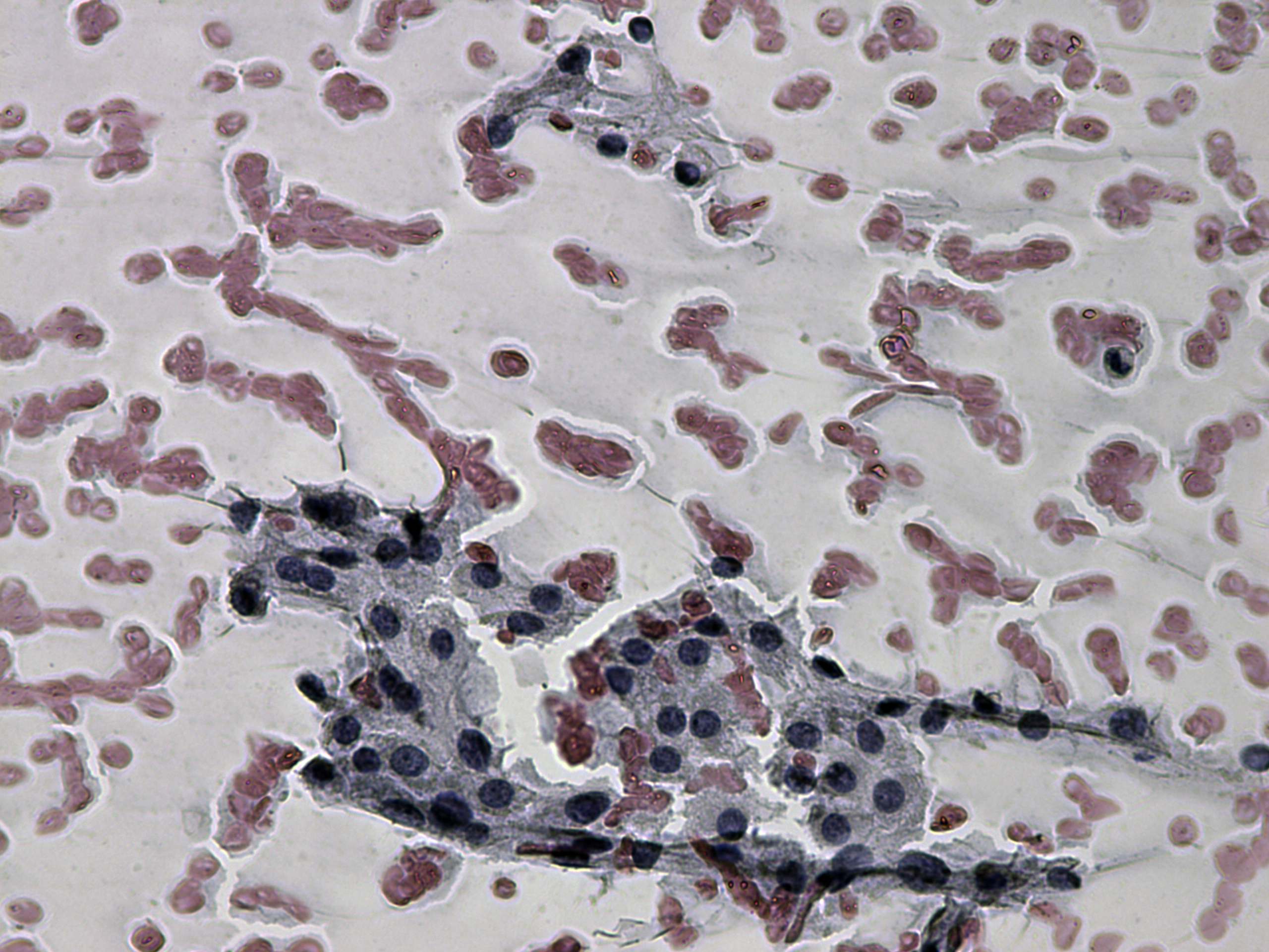 Right lobe, longitudinal scan