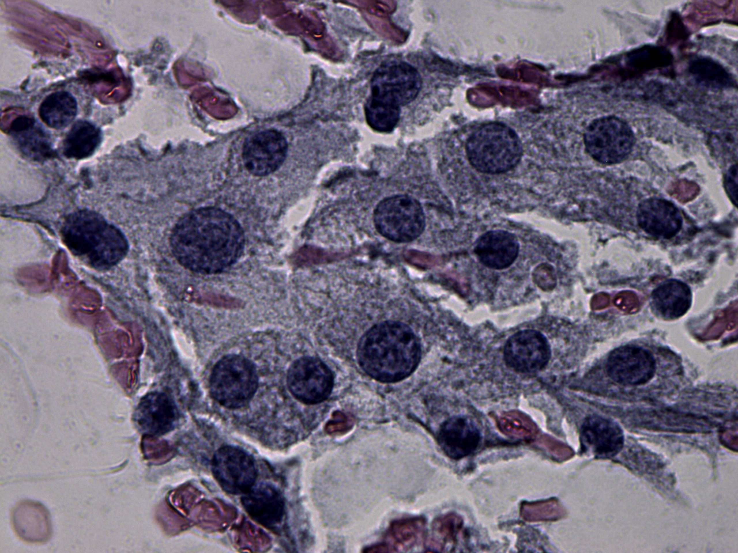 Right lobe, longitudinal scan