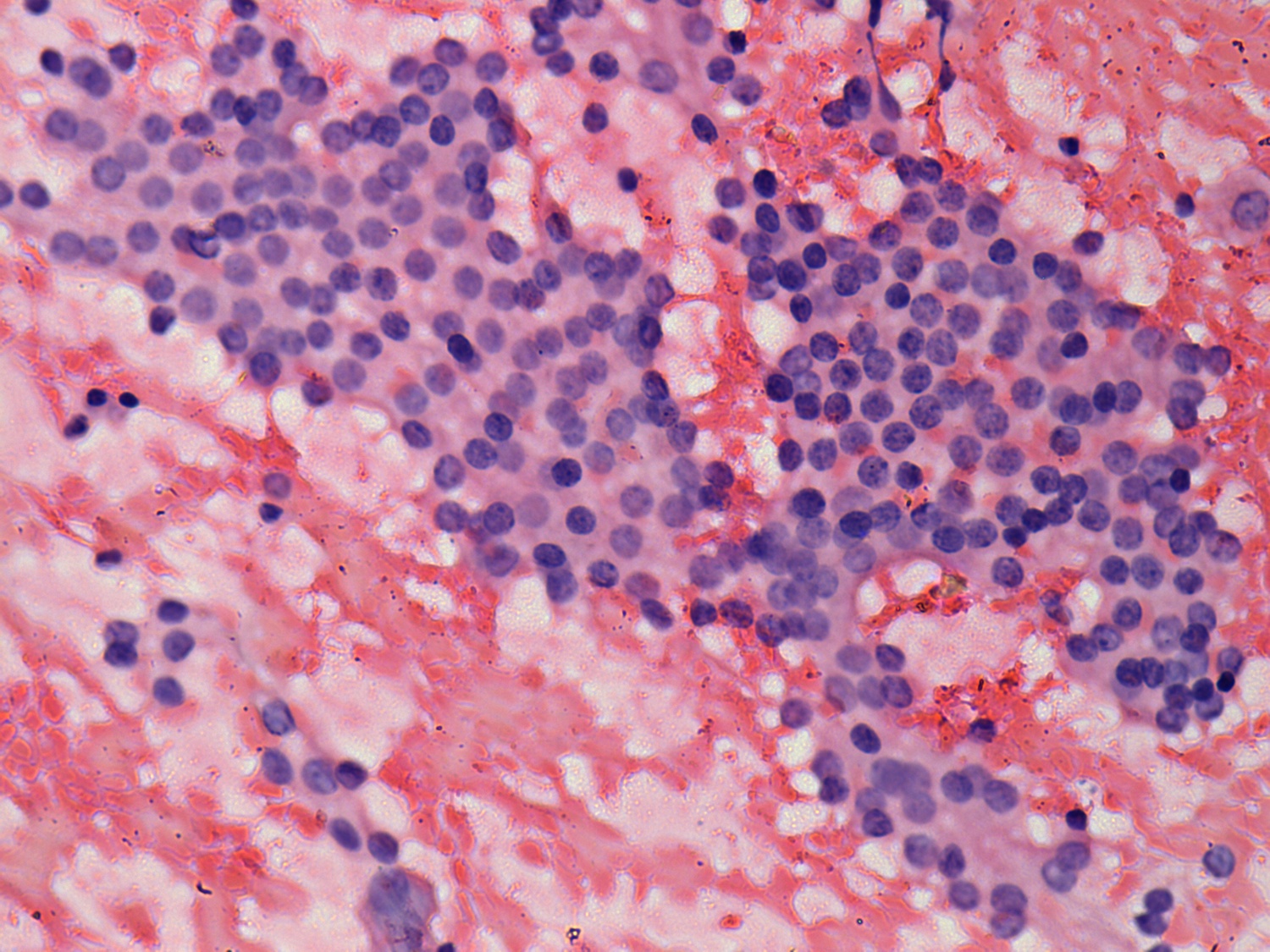 Right lobe, longitudinal scan