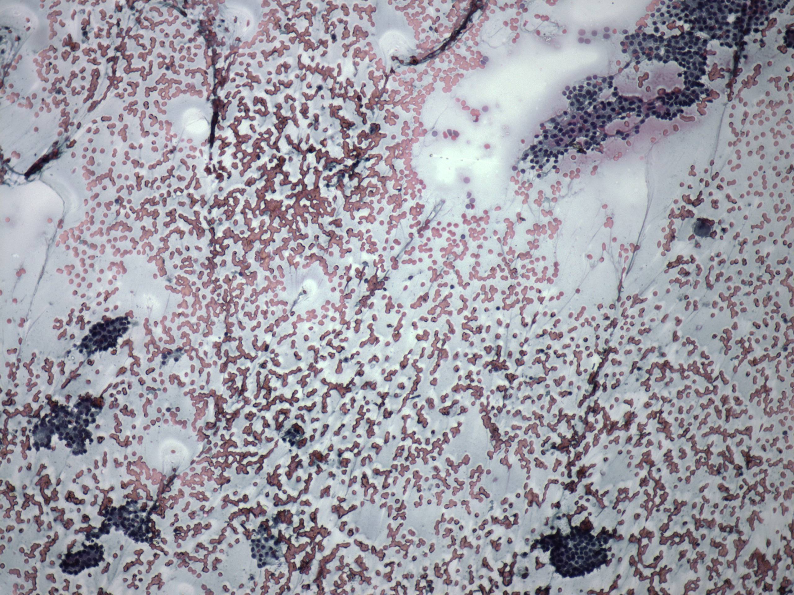 Right lobe, longitudinal scan