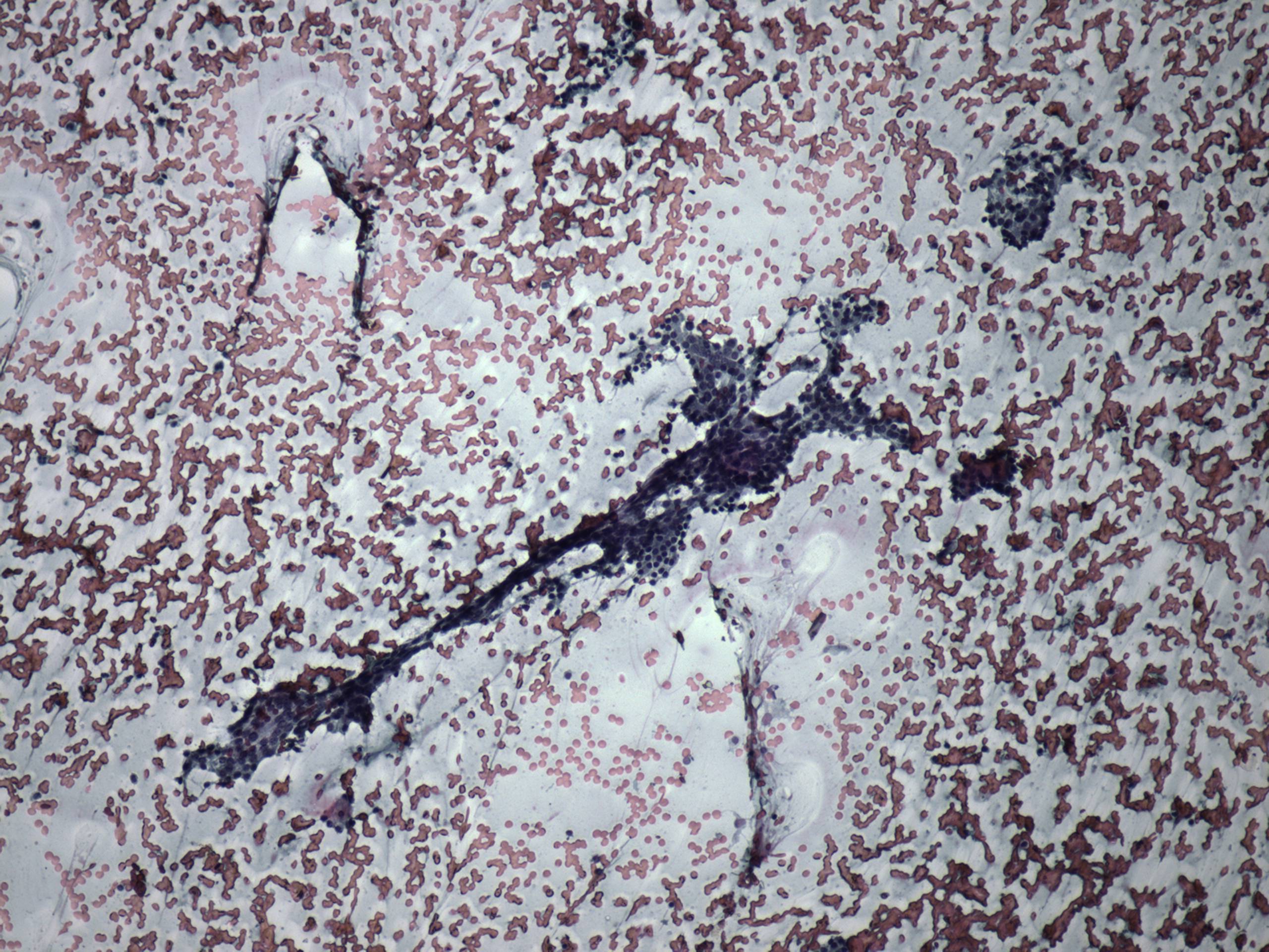 Right lobe, longitudinal scan