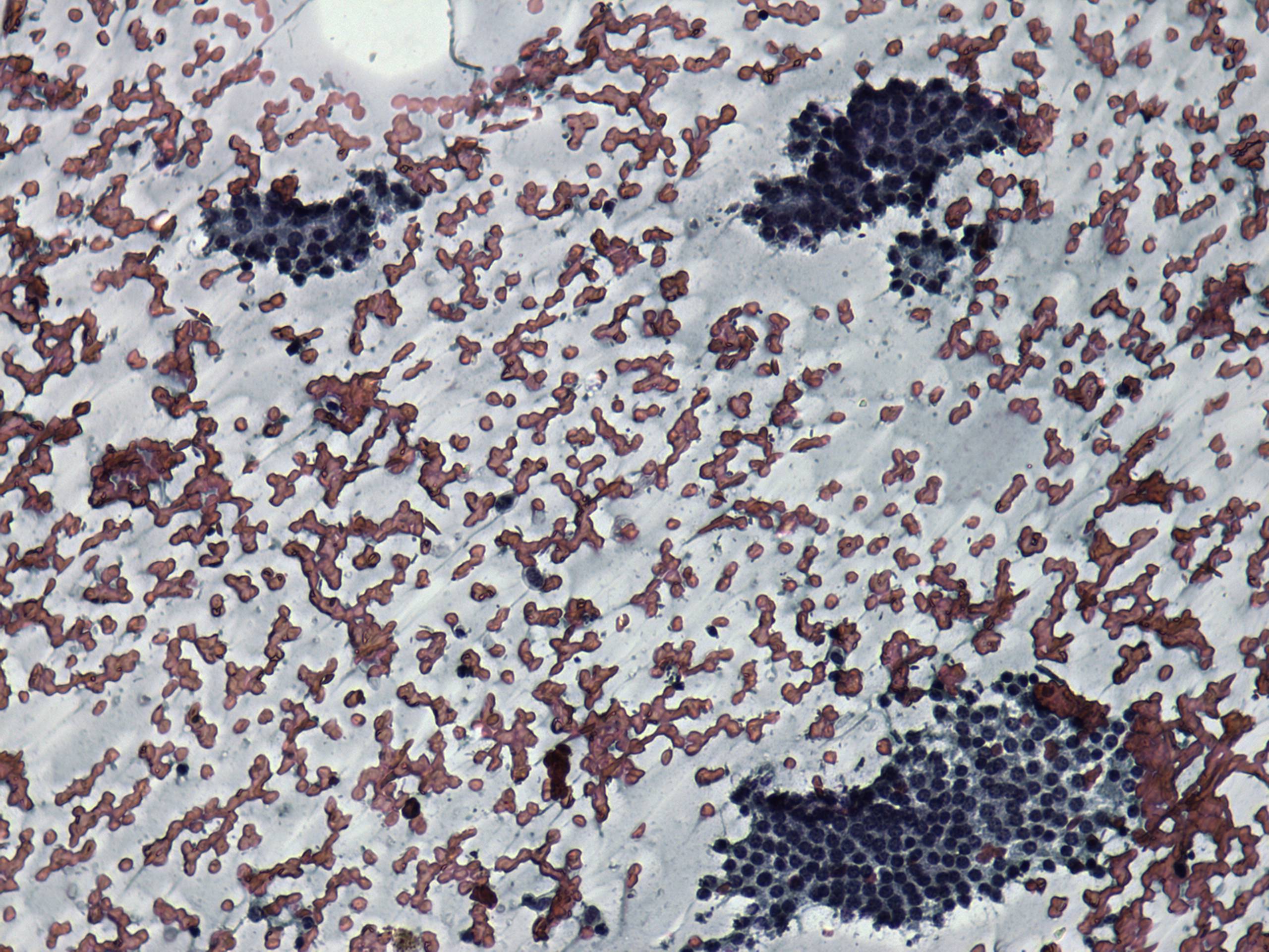 Right lobe, longitudinal scan