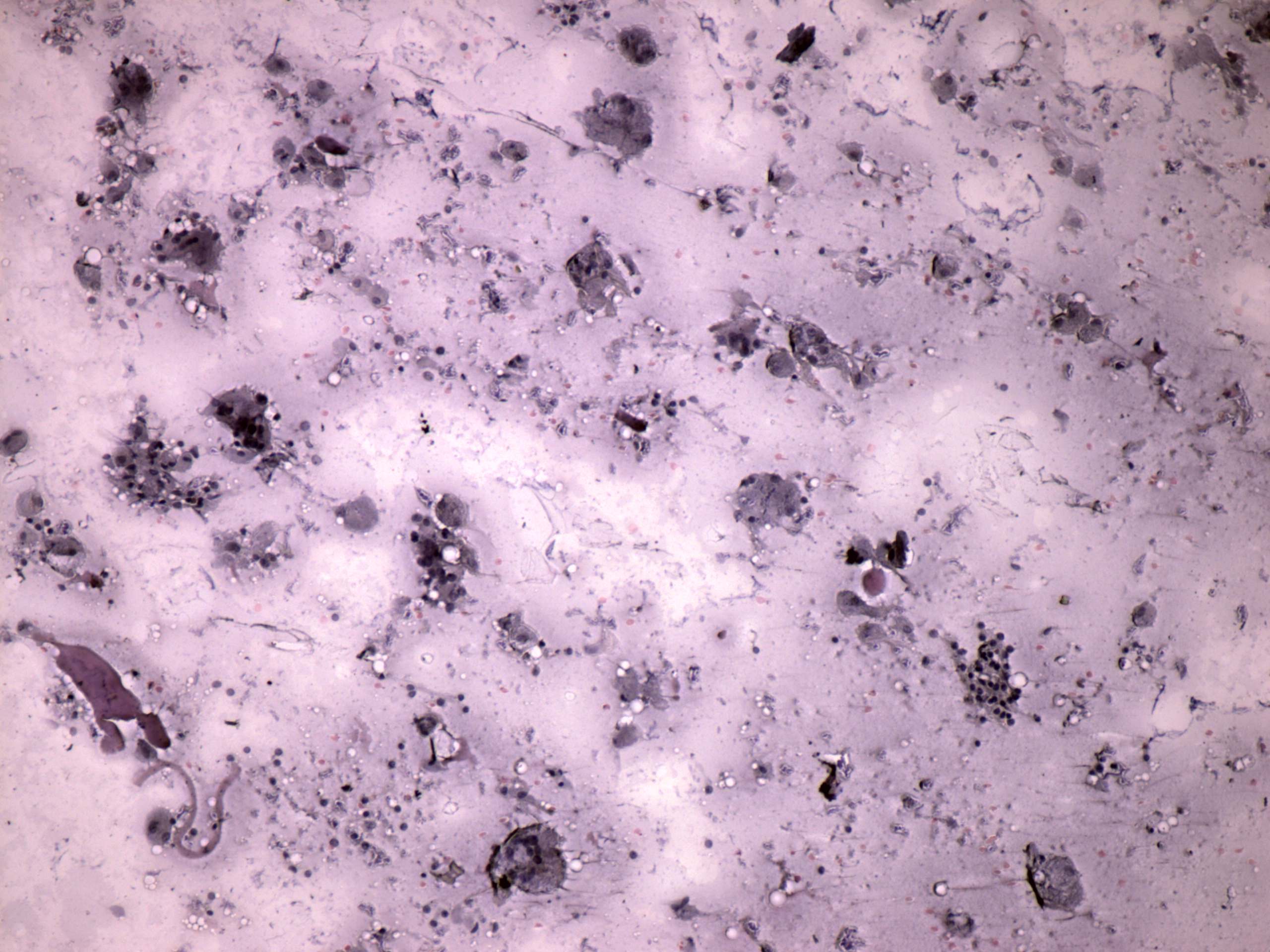 Right lobe, longitudinal scan