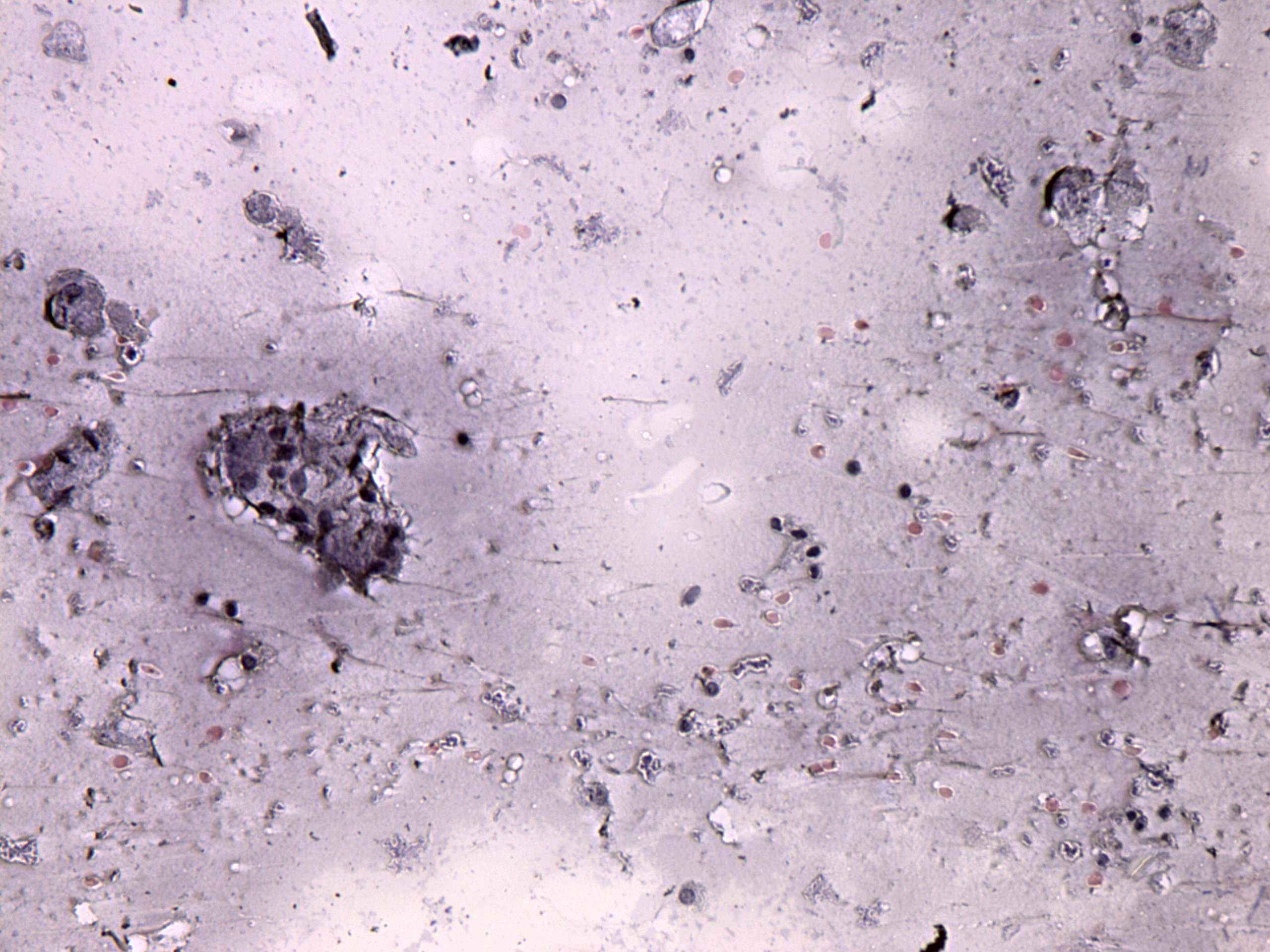 Right lobe, longitudinal scan