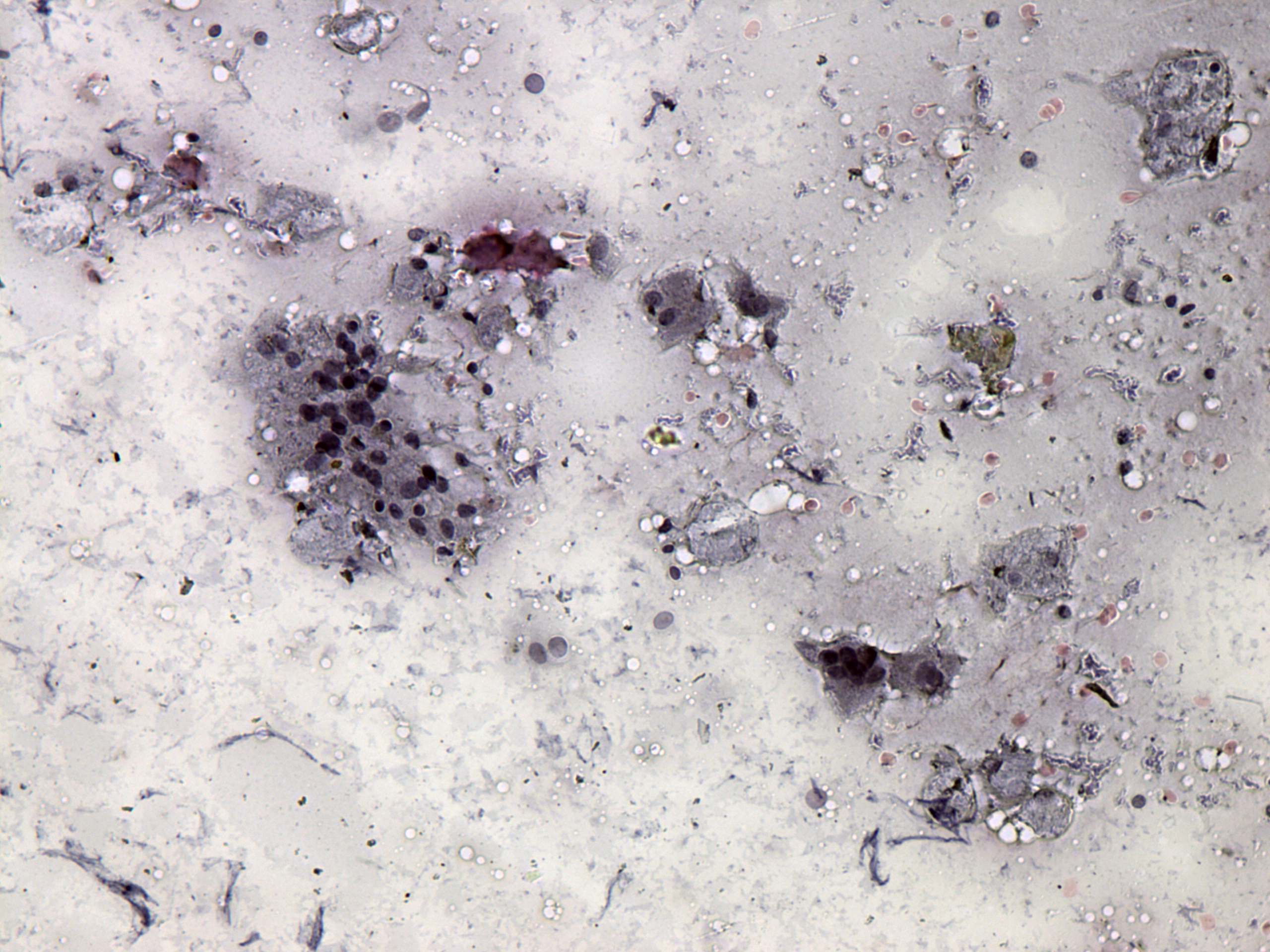 Right lobe, longitudinal scan