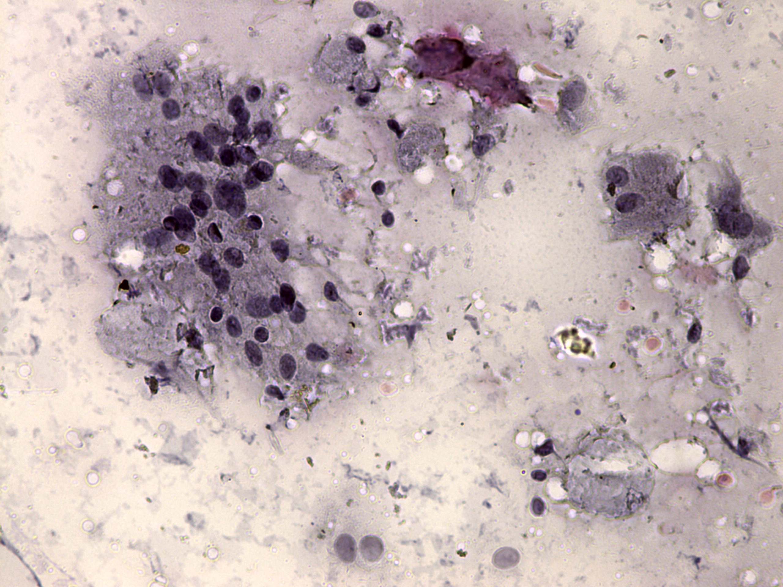 Right lobe, longitudinal scan
