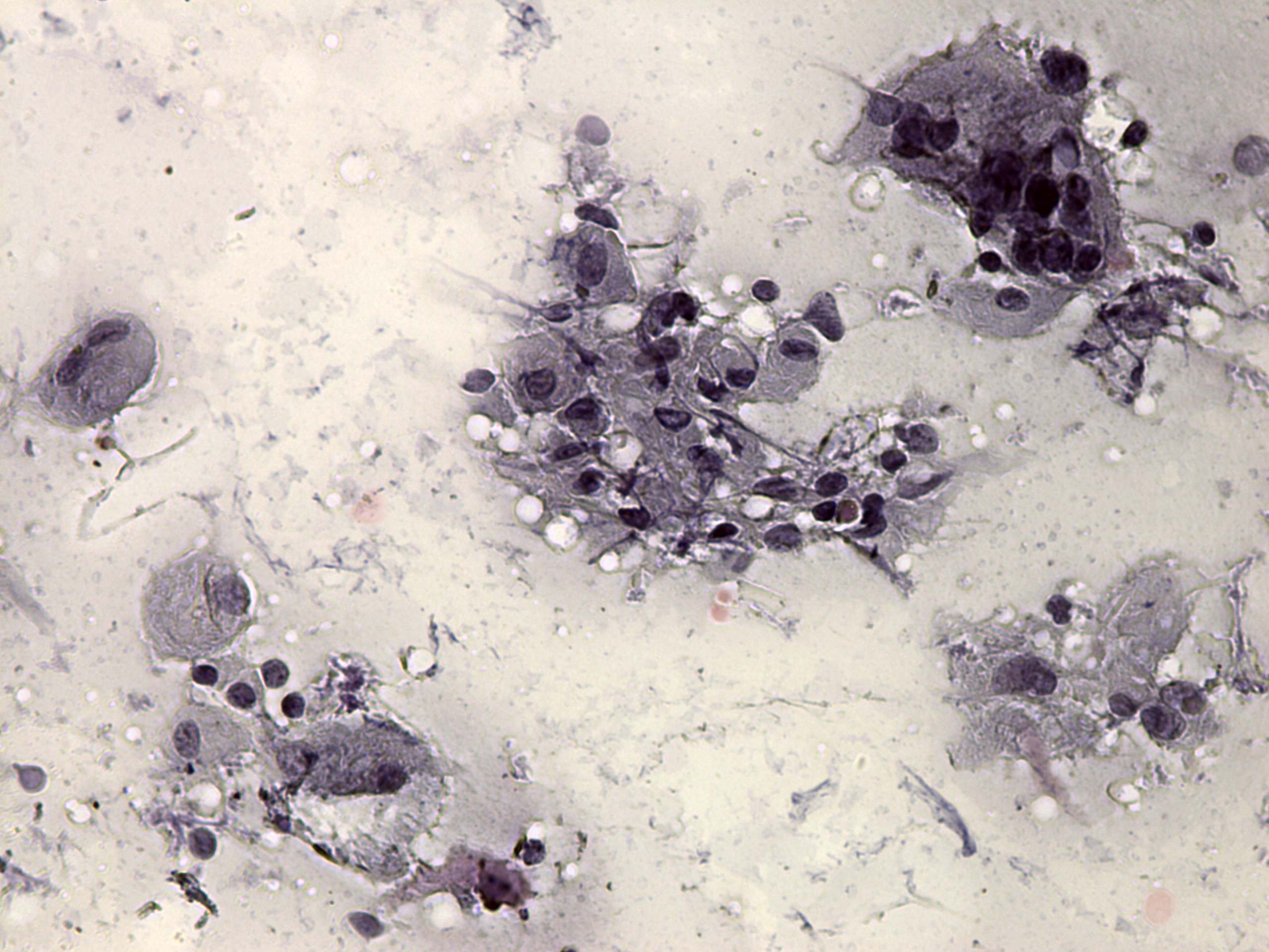 Right lobe, longitudinal scan