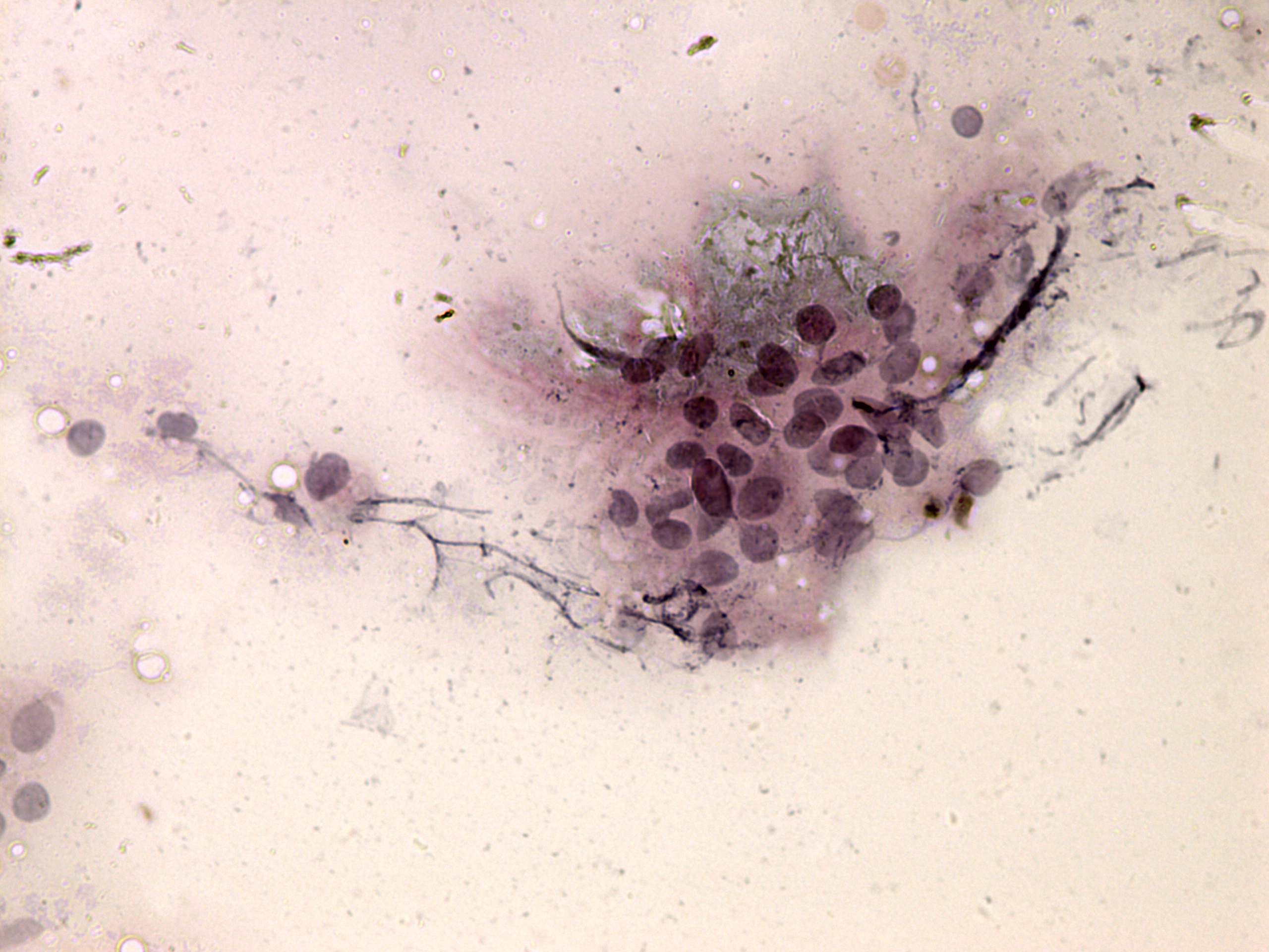 Right lobe, longitudinal scan