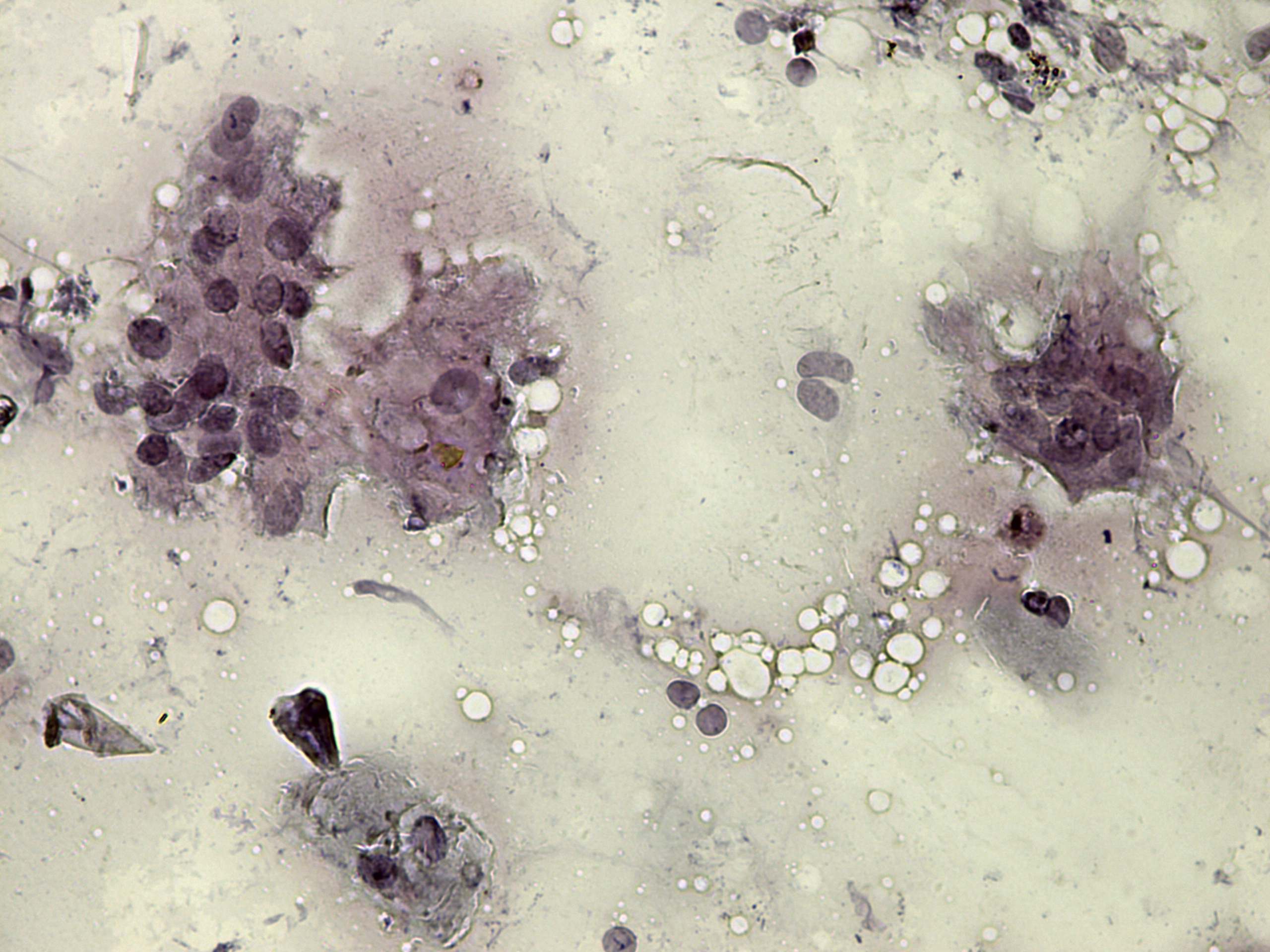 Right lobe, longitudinal scan