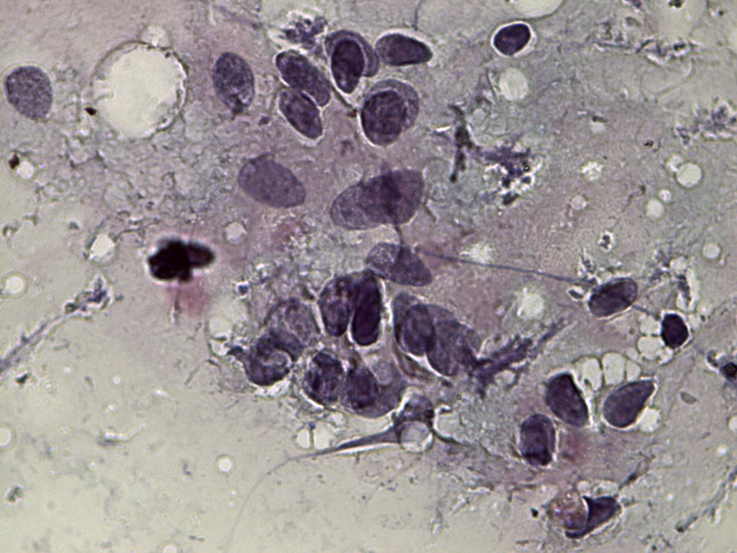 Right lobe, longitudinal scan
