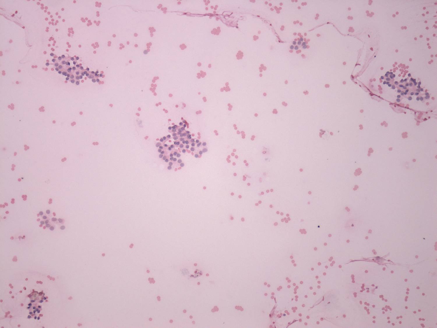 Right lobe, longitudinal scan