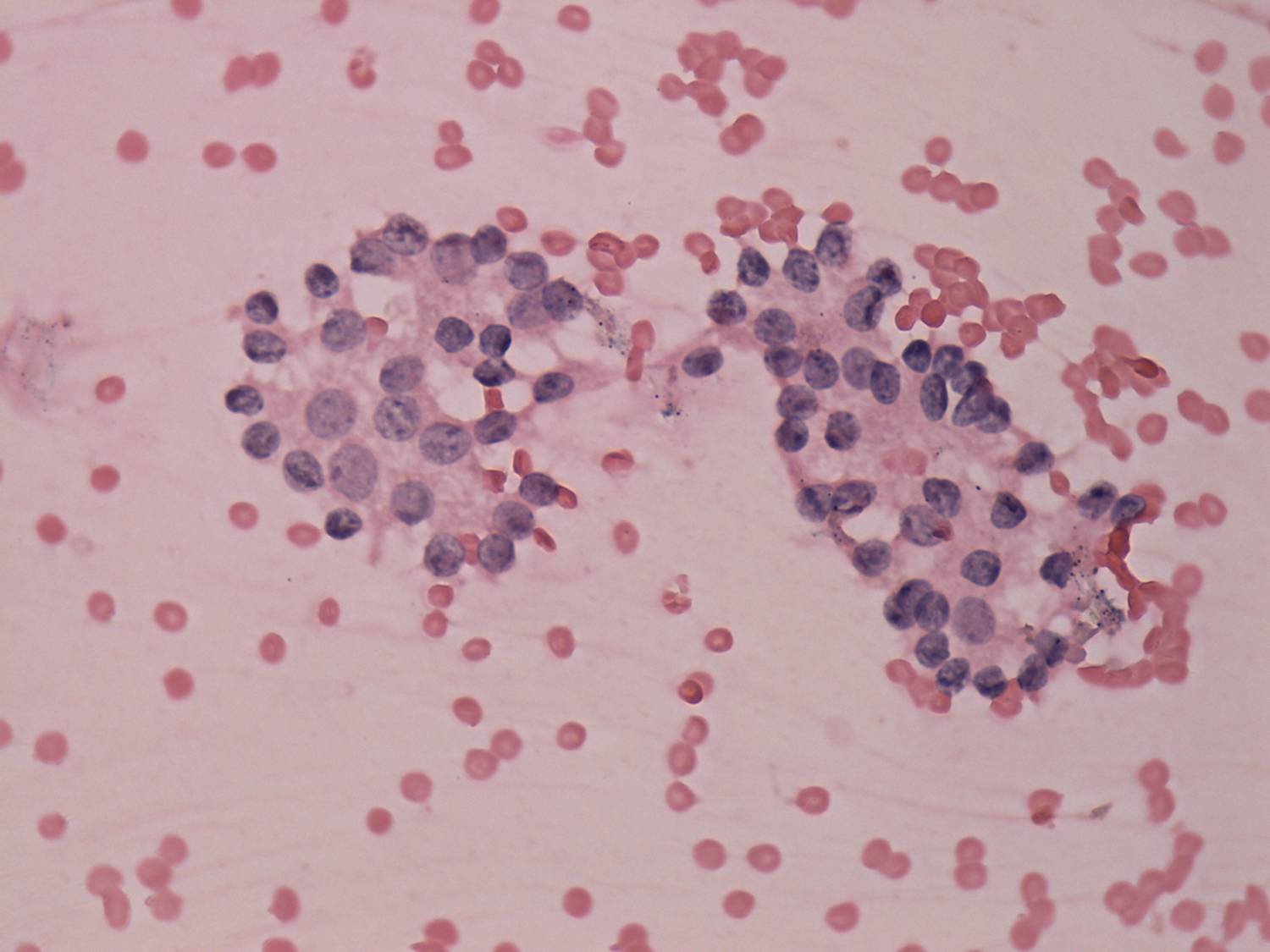 Right lobe, longitudinal scan