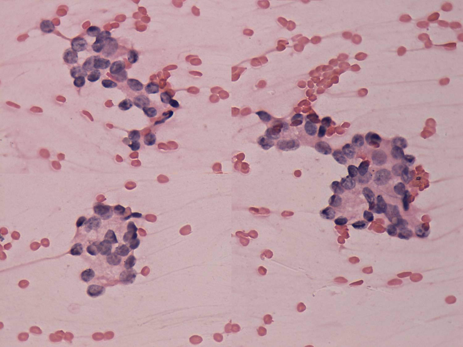 Right lobe, longitudinal scan