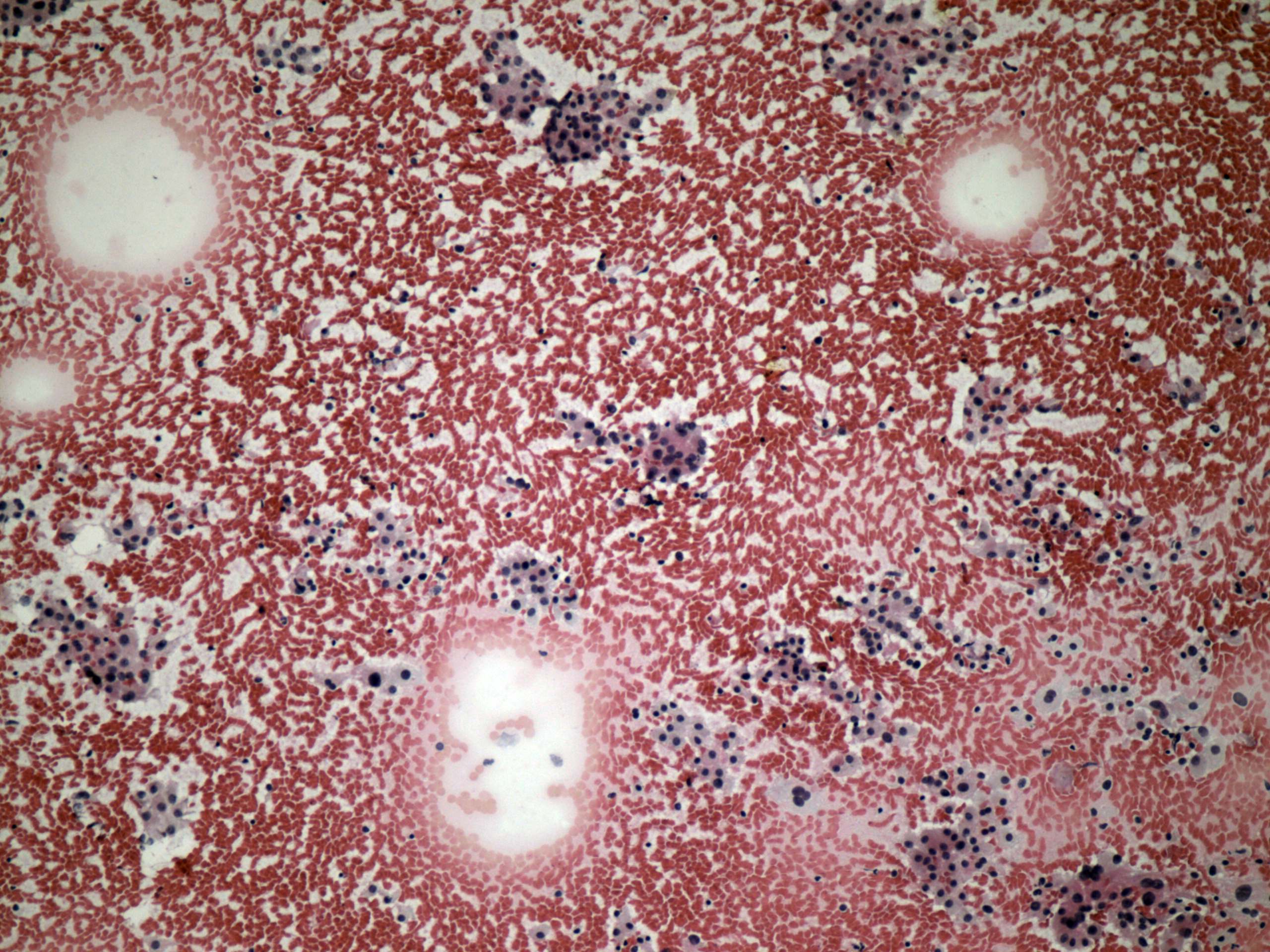 Right lobe, longitudinal scan