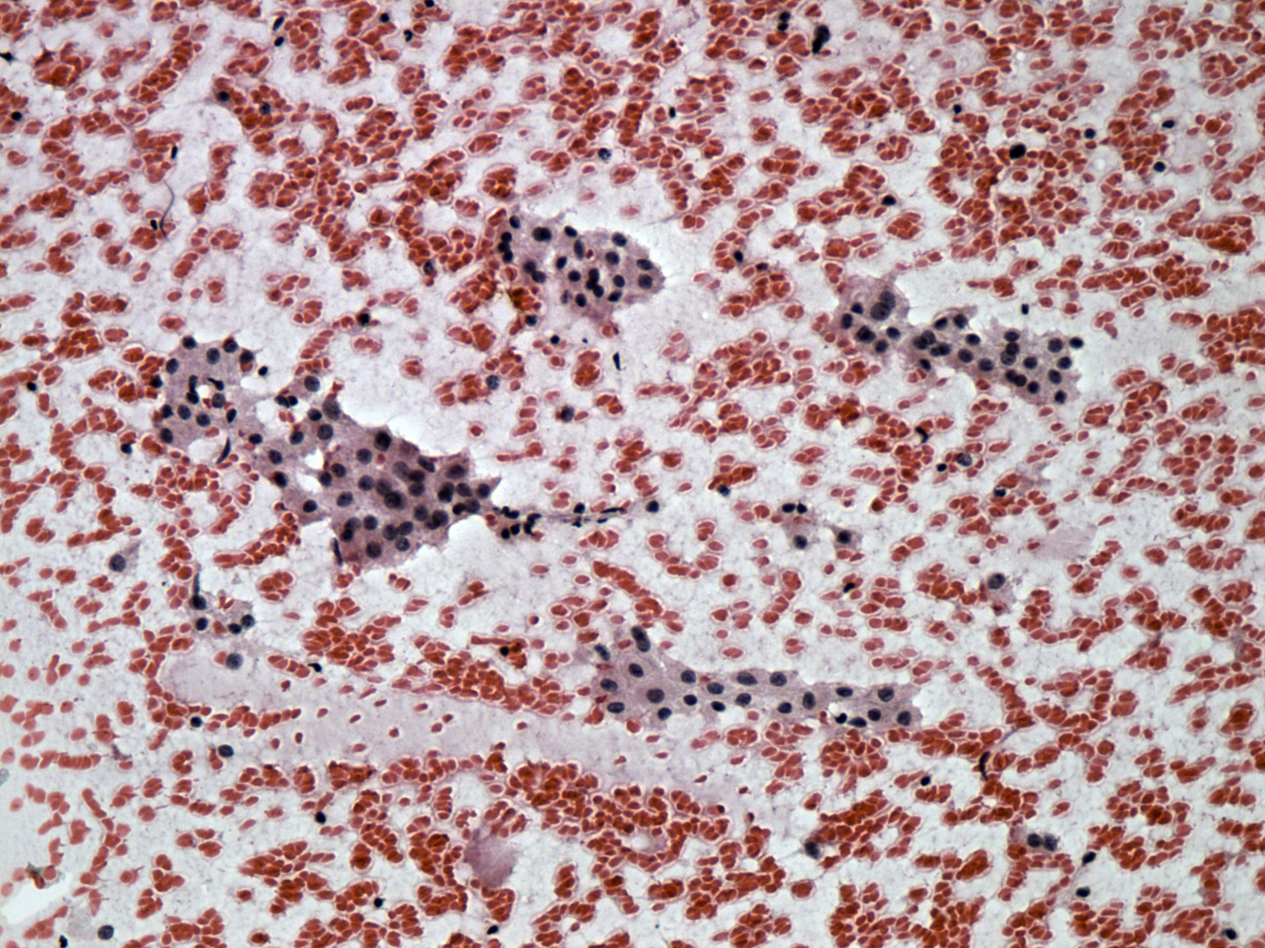 Right lobe, longitudinal scan