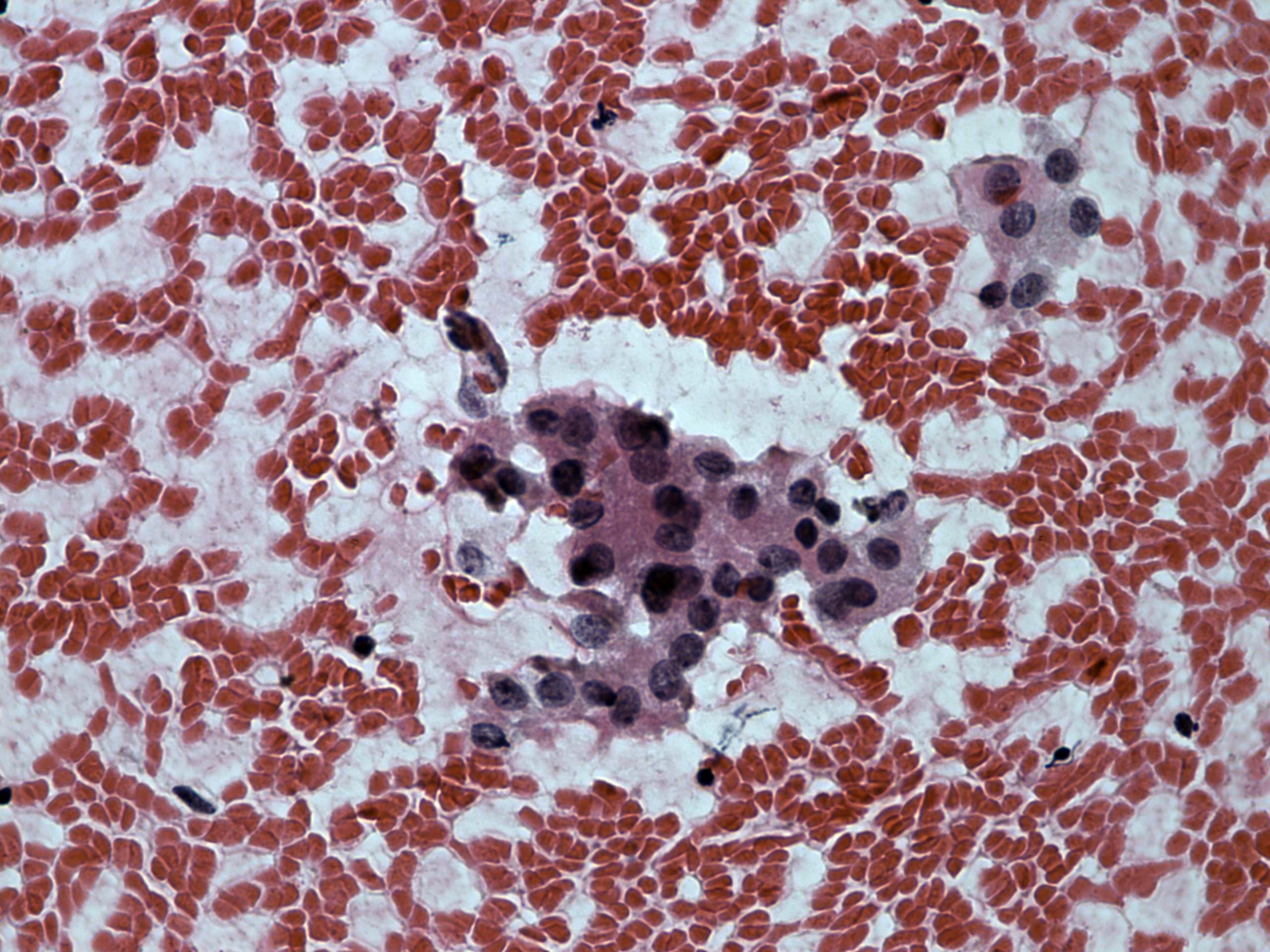 Right lobe, longitudinal scan