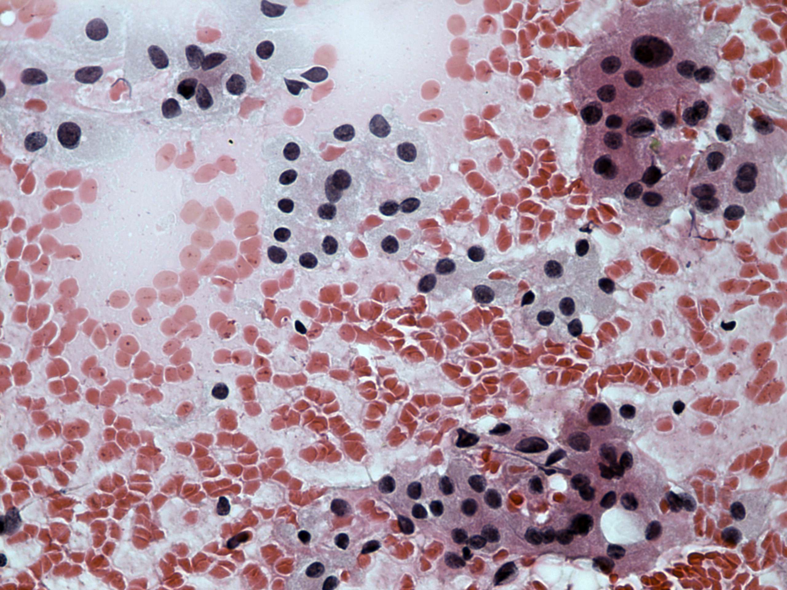 Right lobe, longitudinal scan