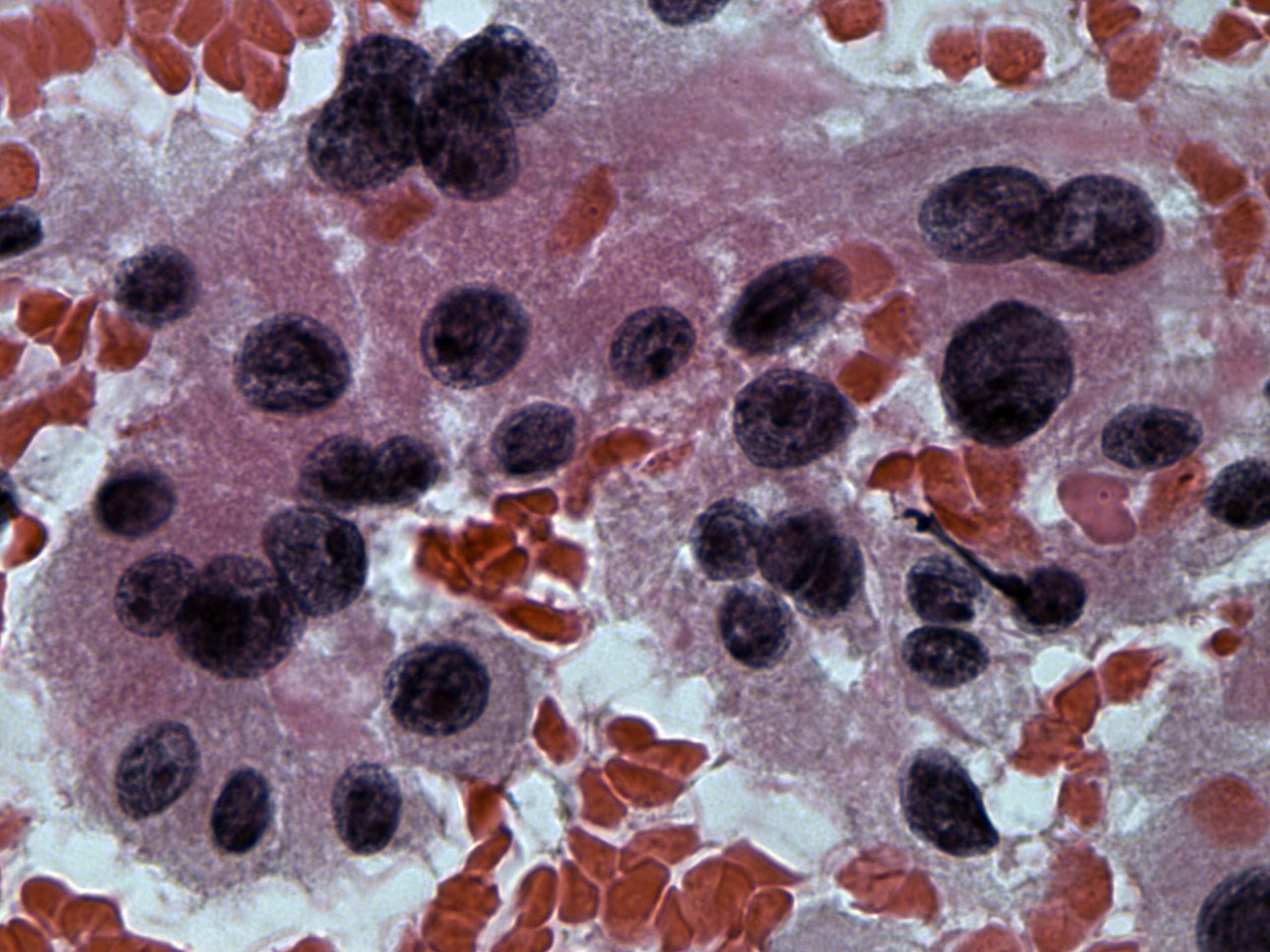 Right lobe, longitudinal scan