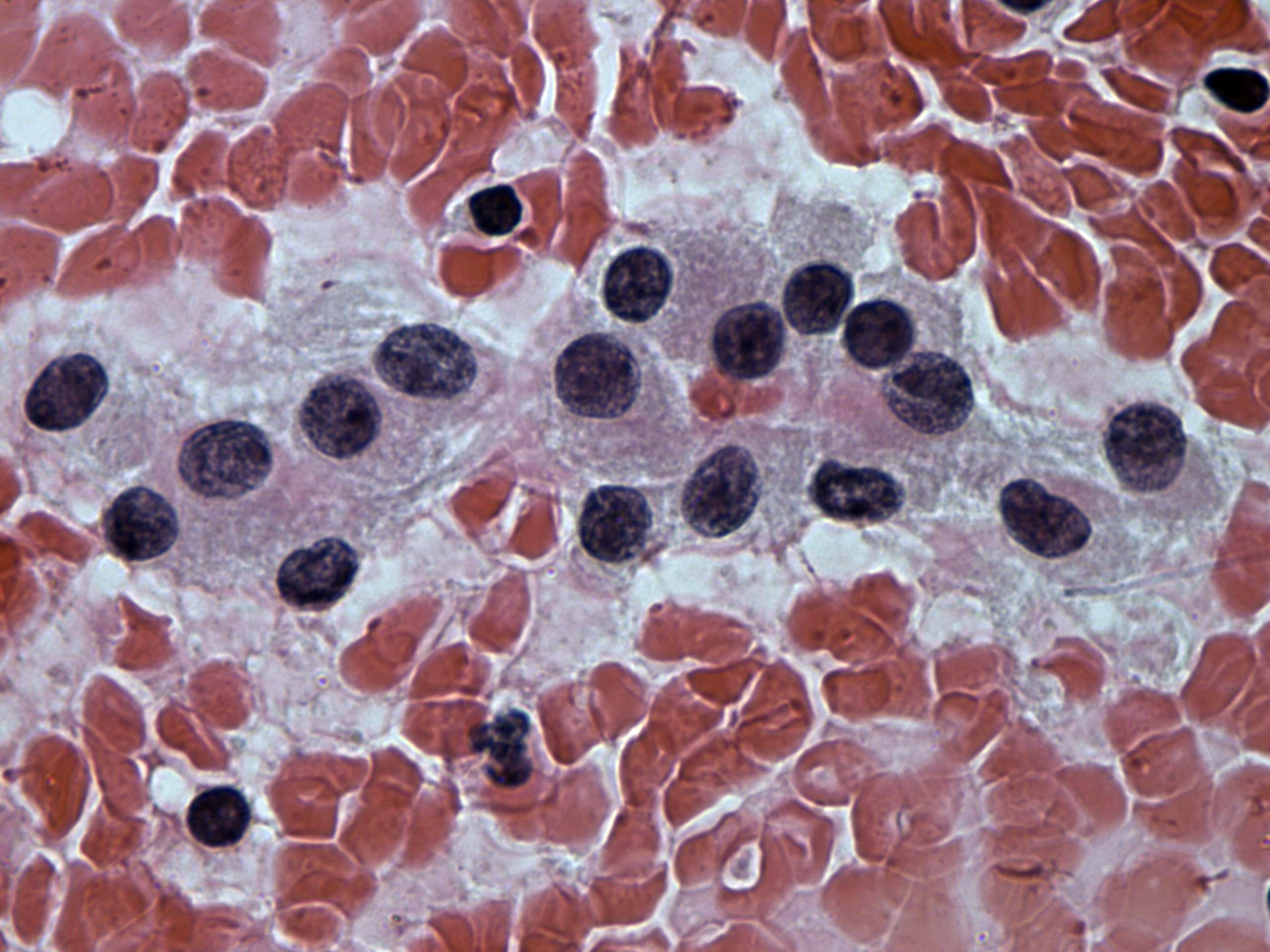 Right lobe, longitudinal scan