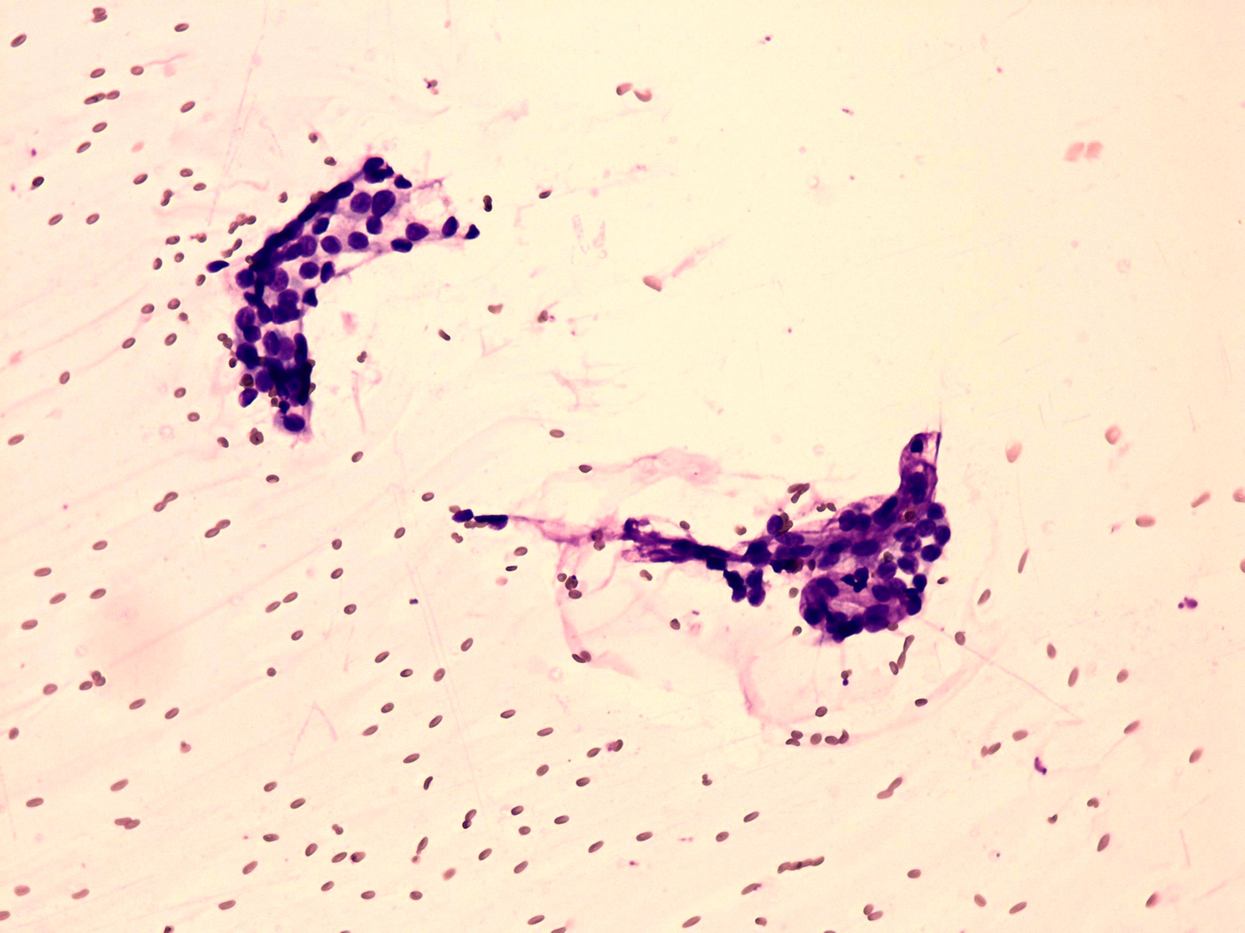 Right lobe, longitudinal scan