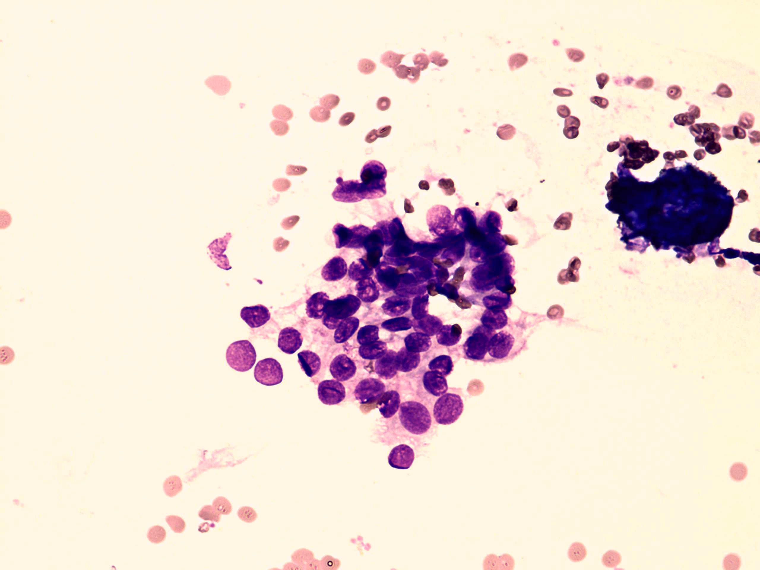 Right lobe, longitudinal scan