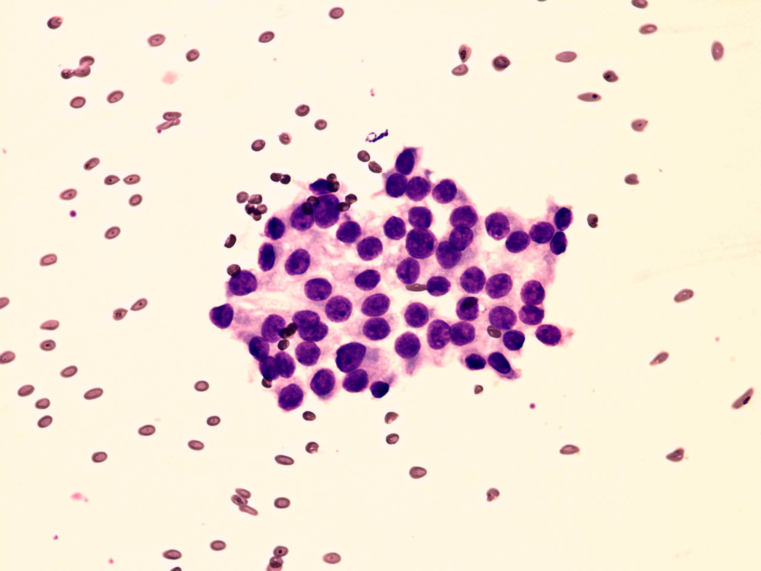 Right lobe, longitudinal scan