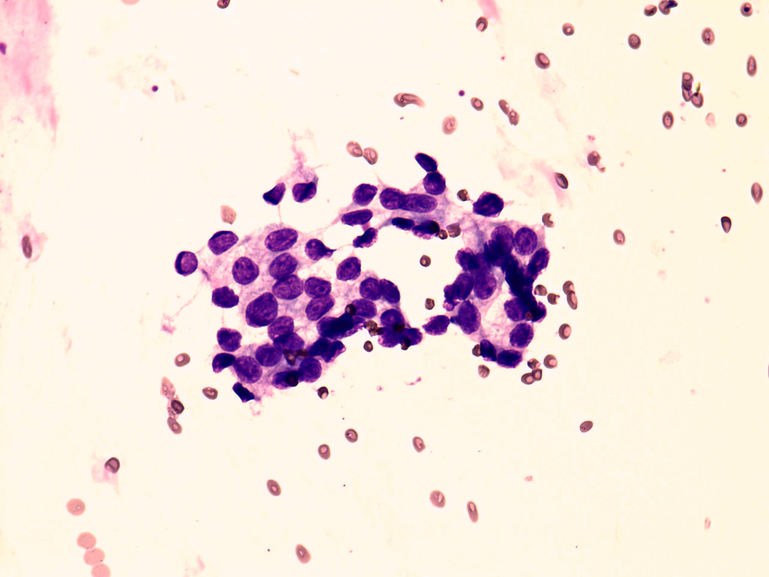 Right lobe, longitudinal scan