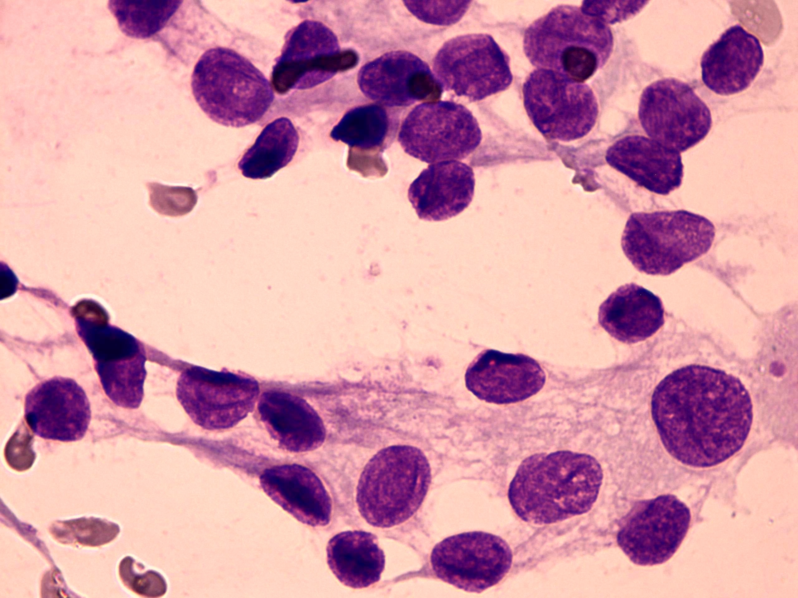Right lobe, longitudinal scan