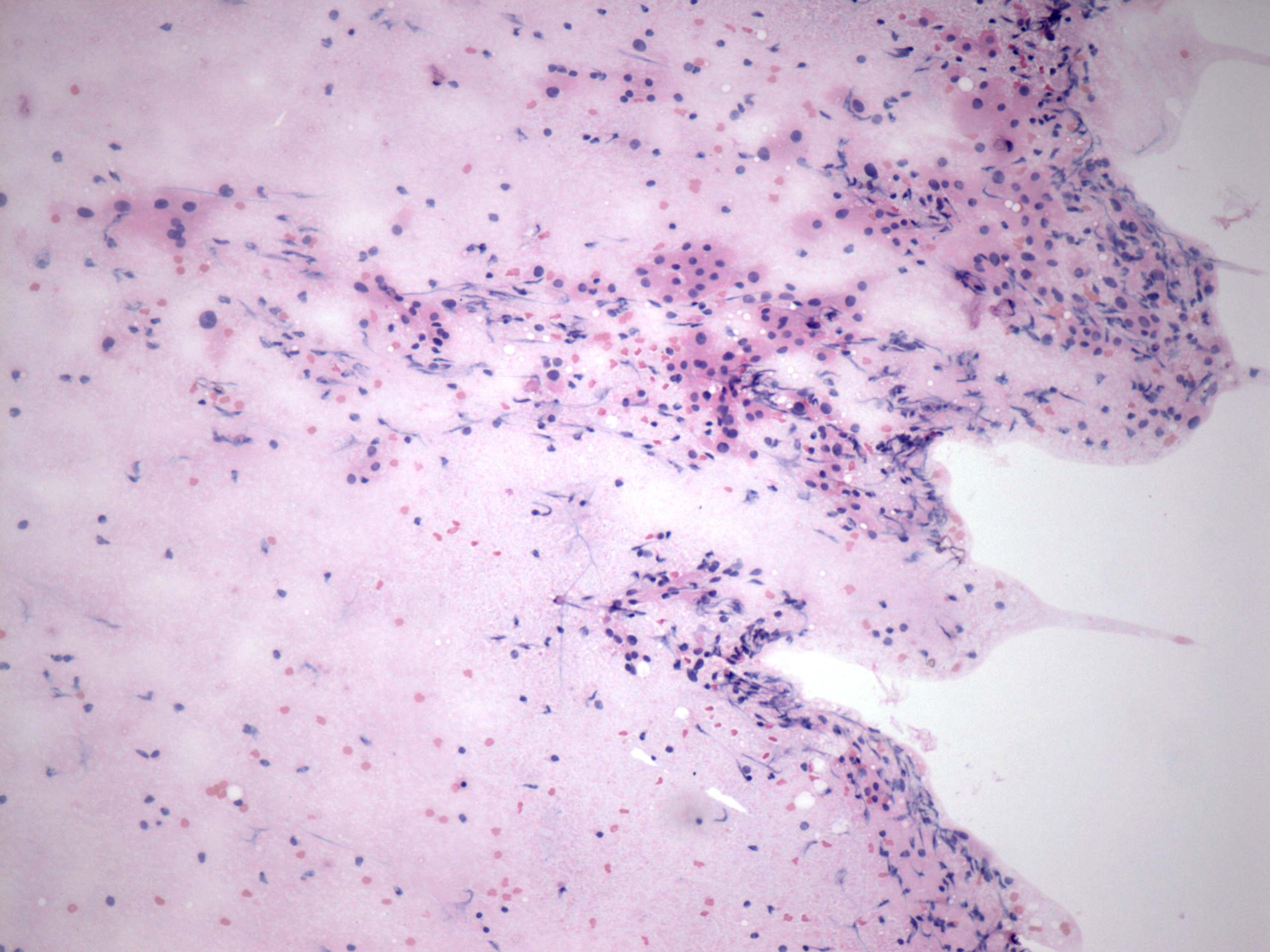 Right lobe, longitudinal scan