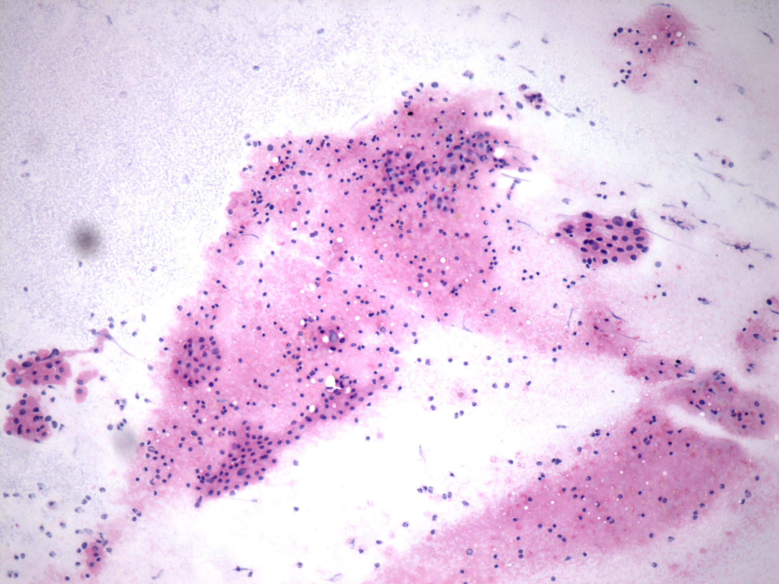 Right lobe, longitudinal scan