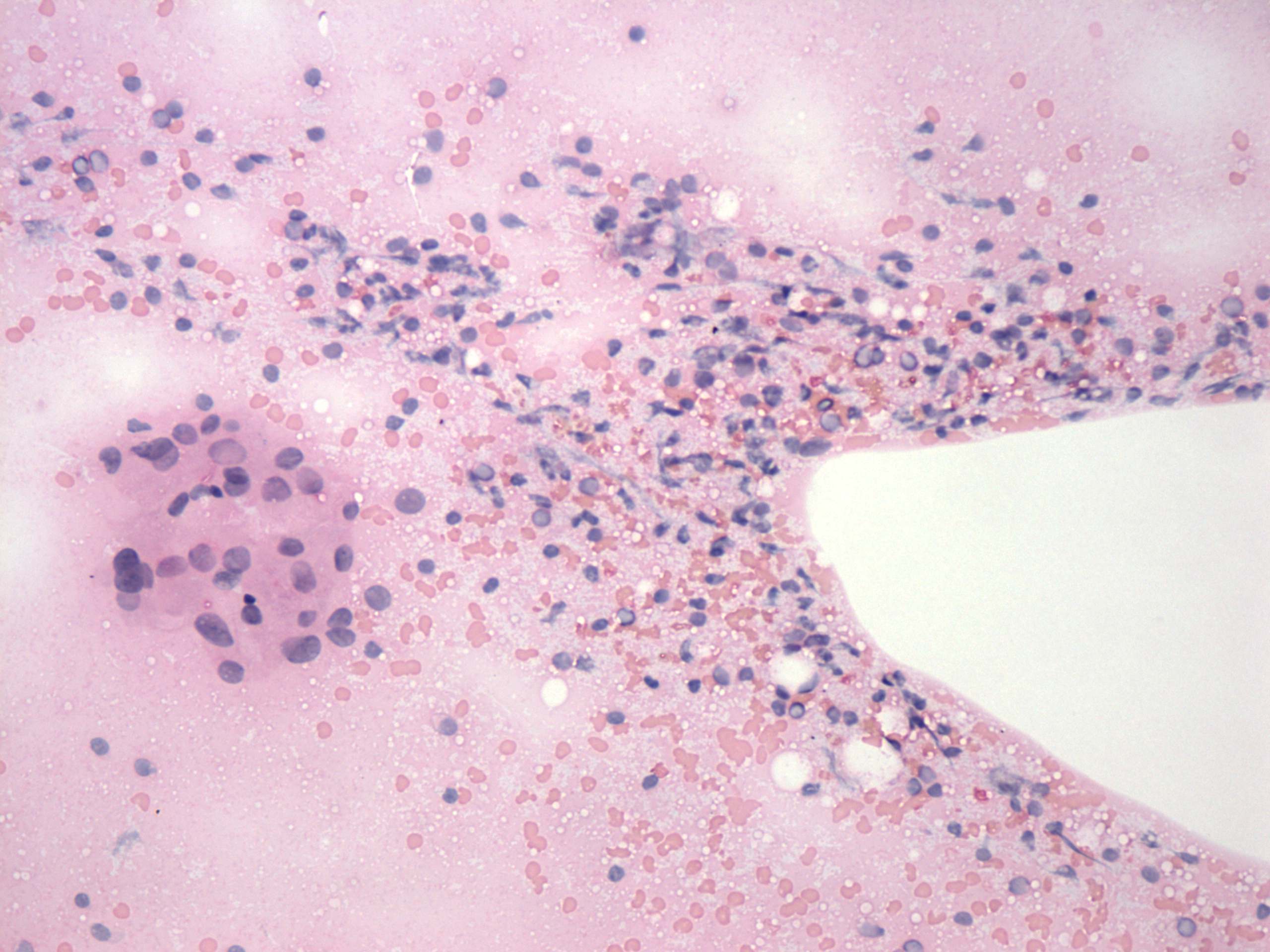 Right lobe, longitudinal scan