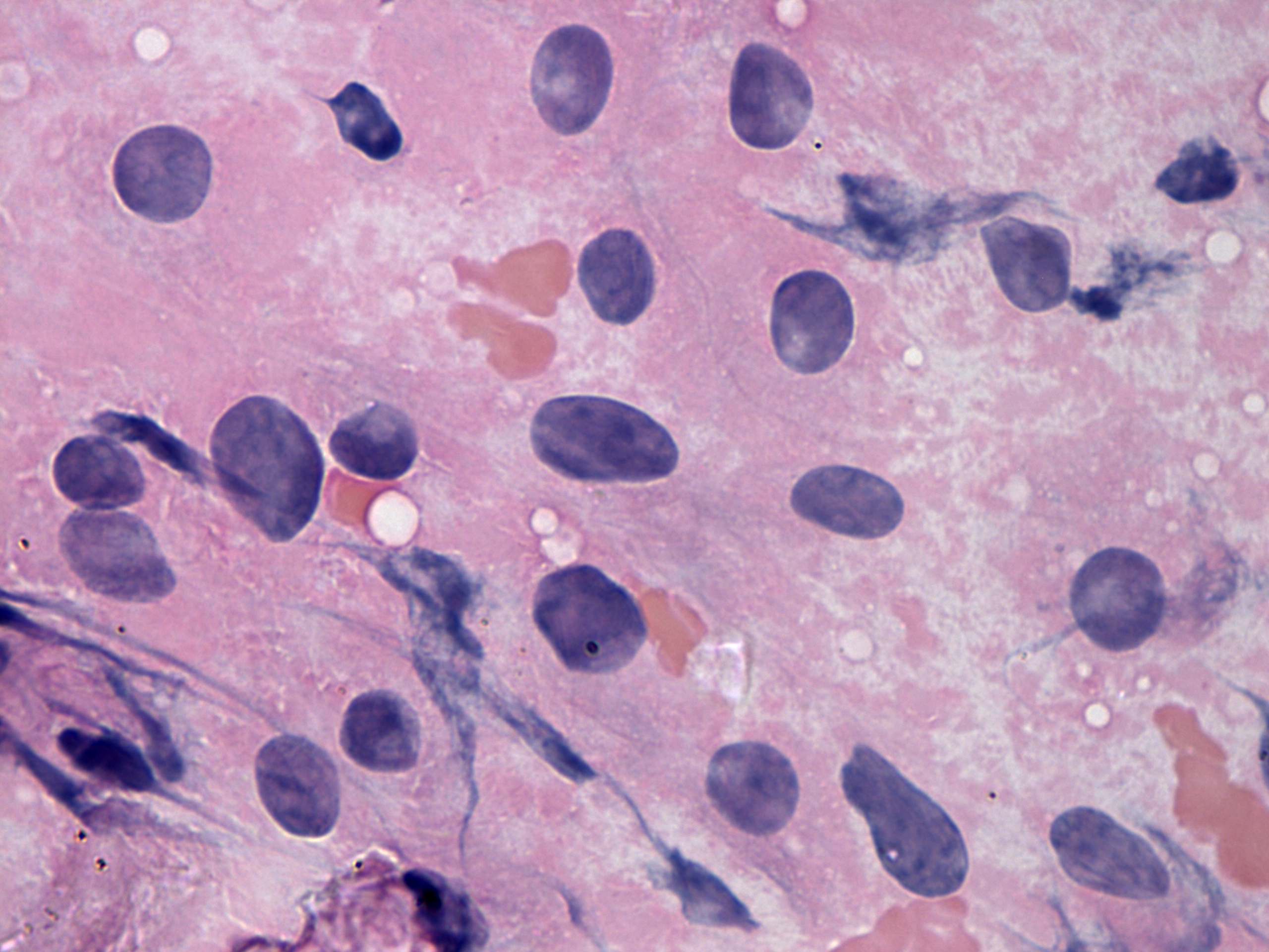 Right lobe, longitudinal scan
