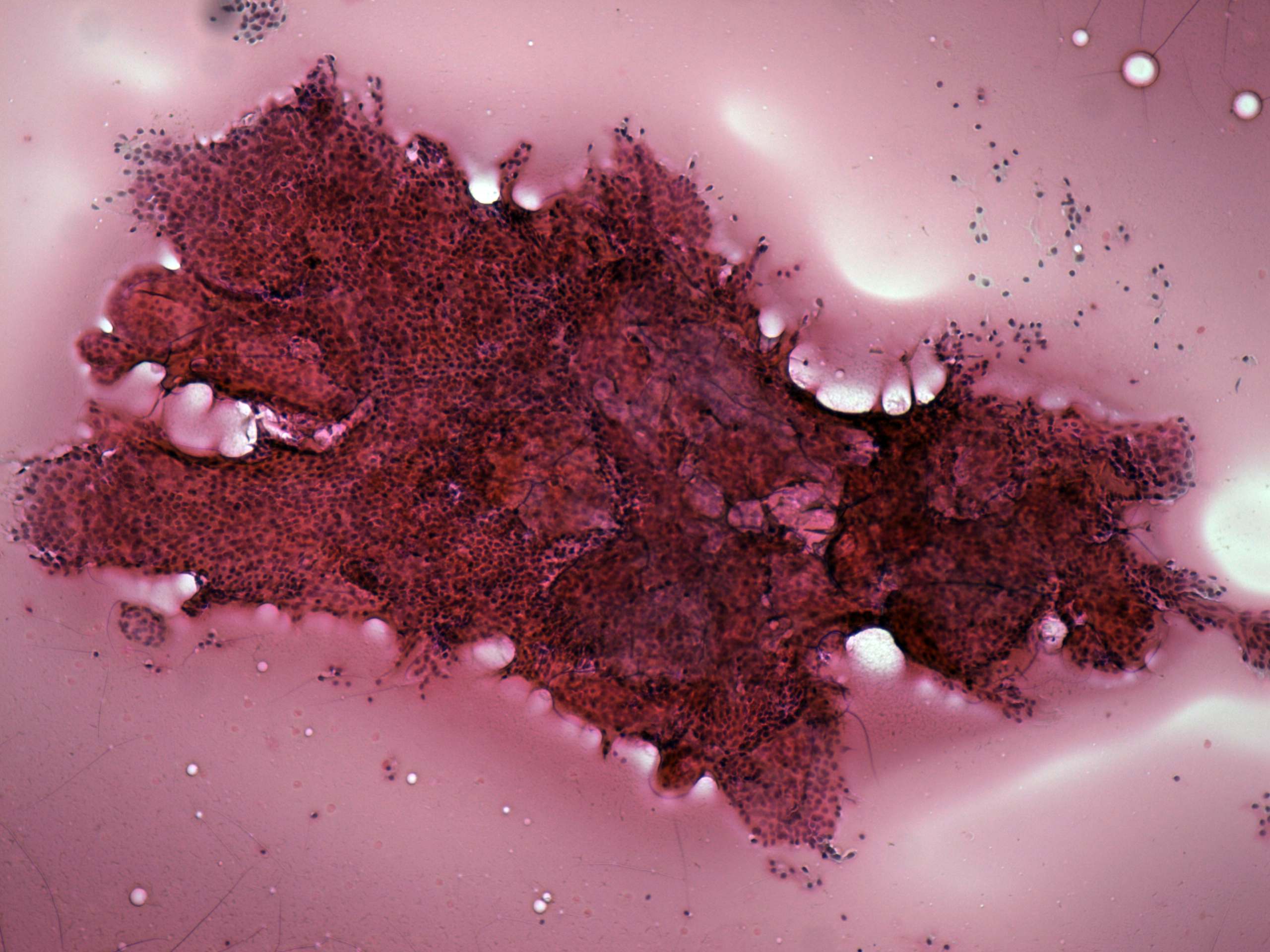 Right lobe, longitudinal scan