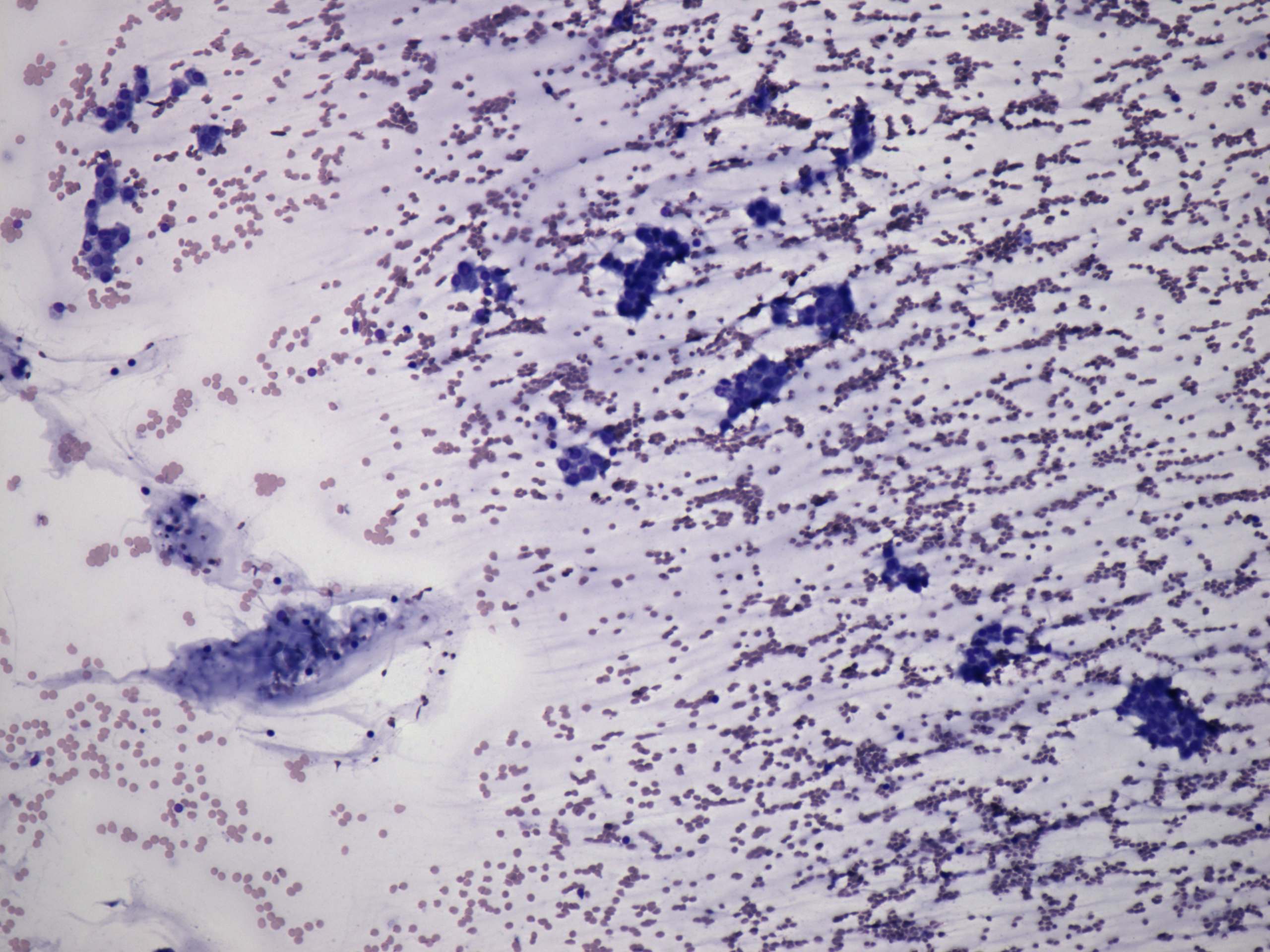 Right lobe, longitudinal scan