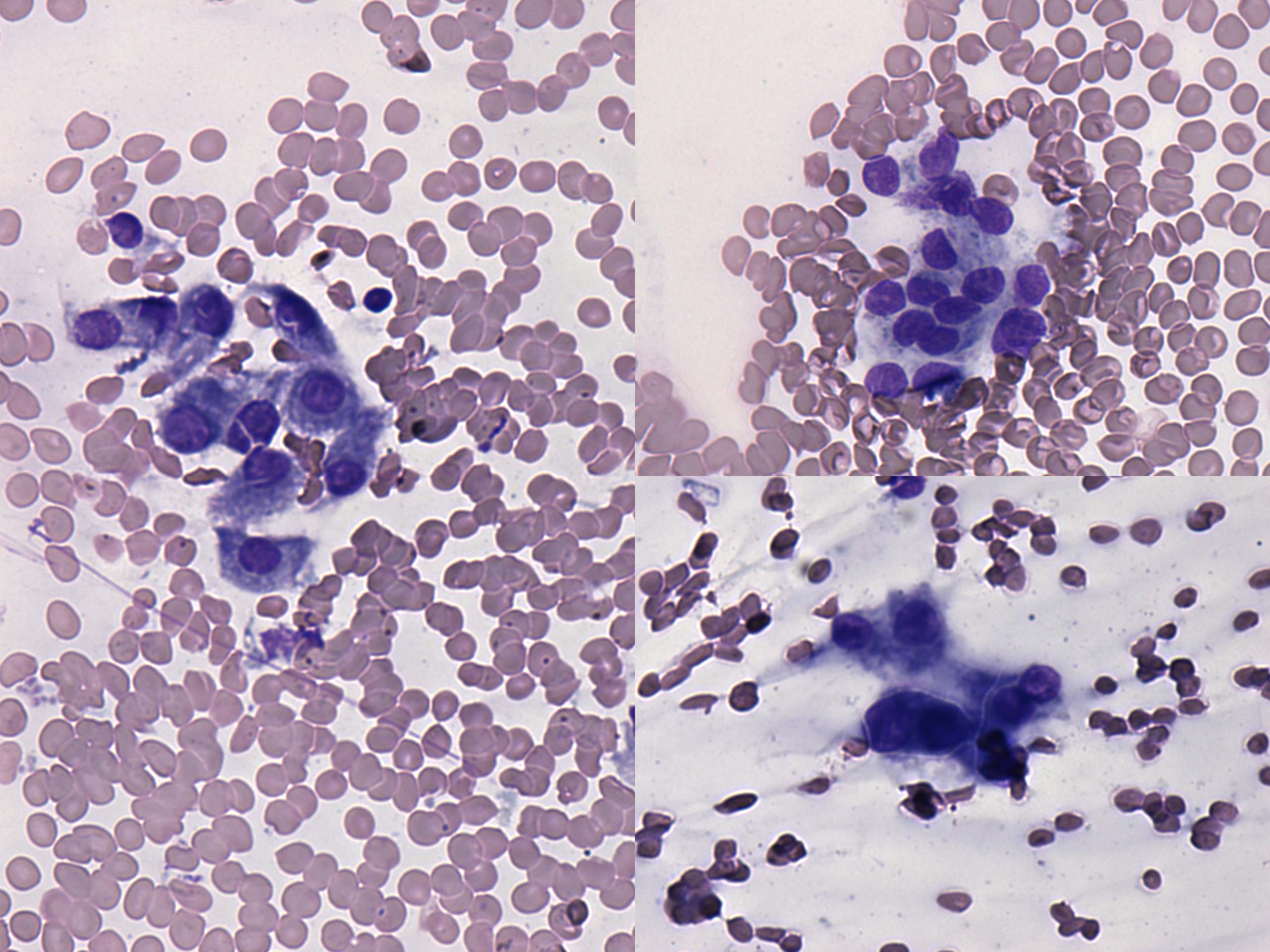 Right lobe, longitudinal scan