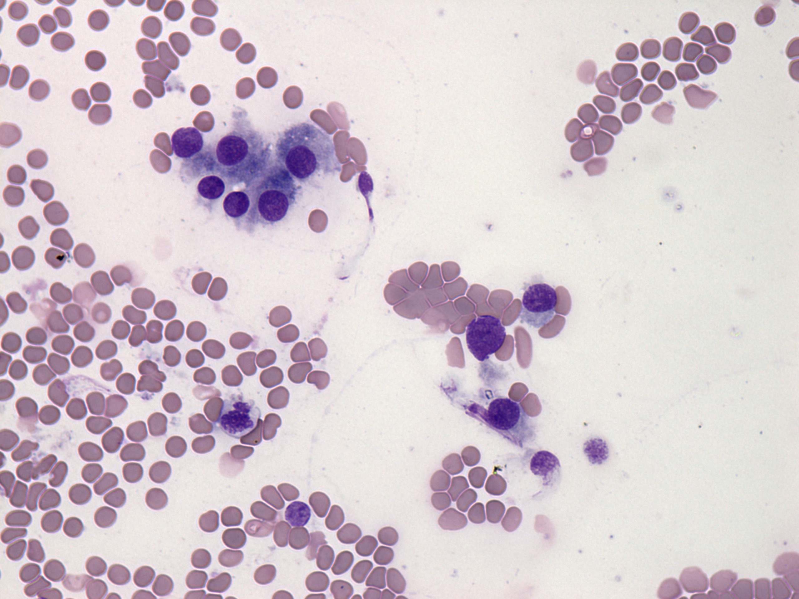 Right lobe, longitudinal scan