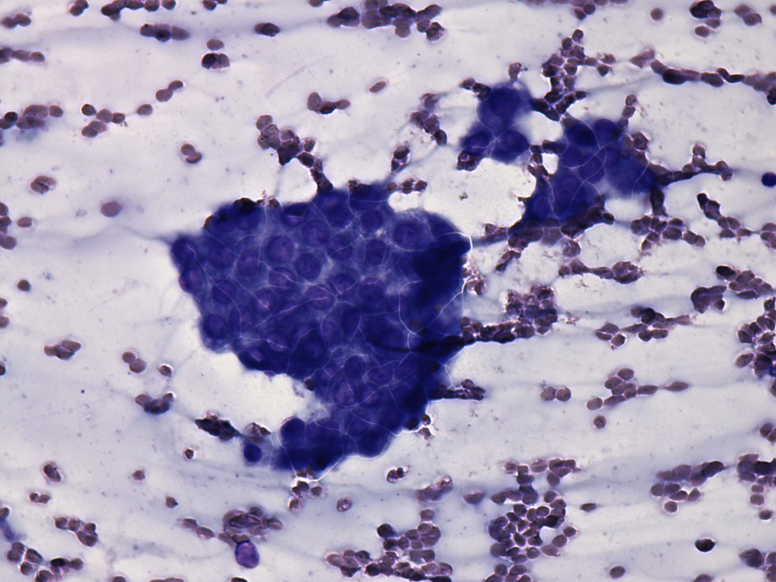 Right lobe, longitudinal scan