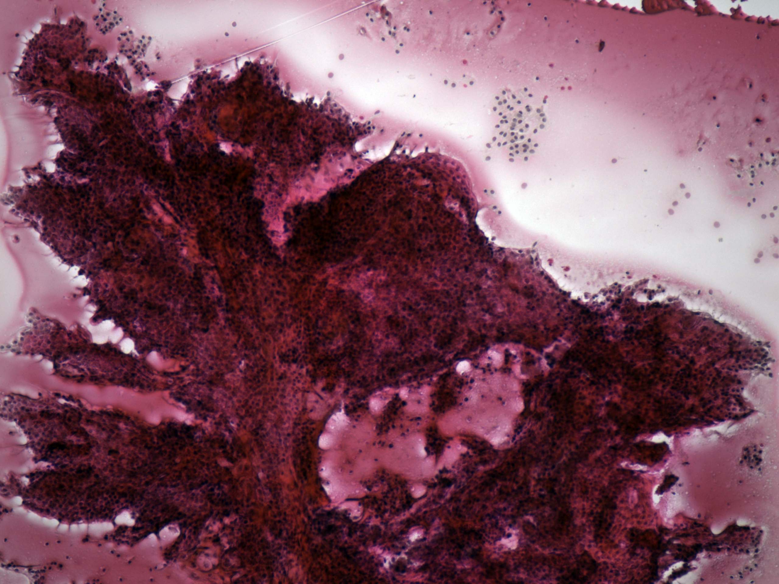 Right lobe, longitudinal scan