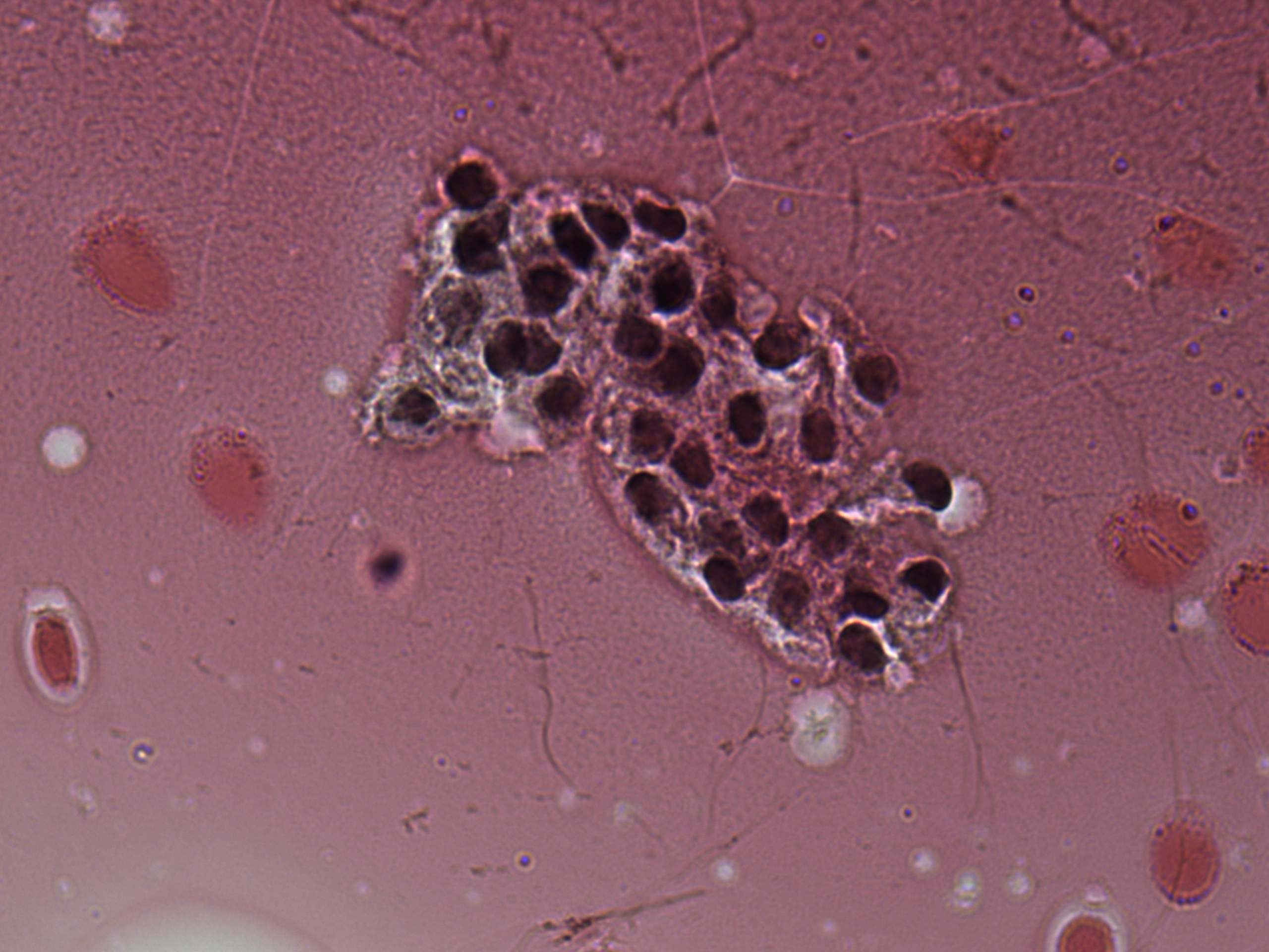 Right lobe, longitudinal scan