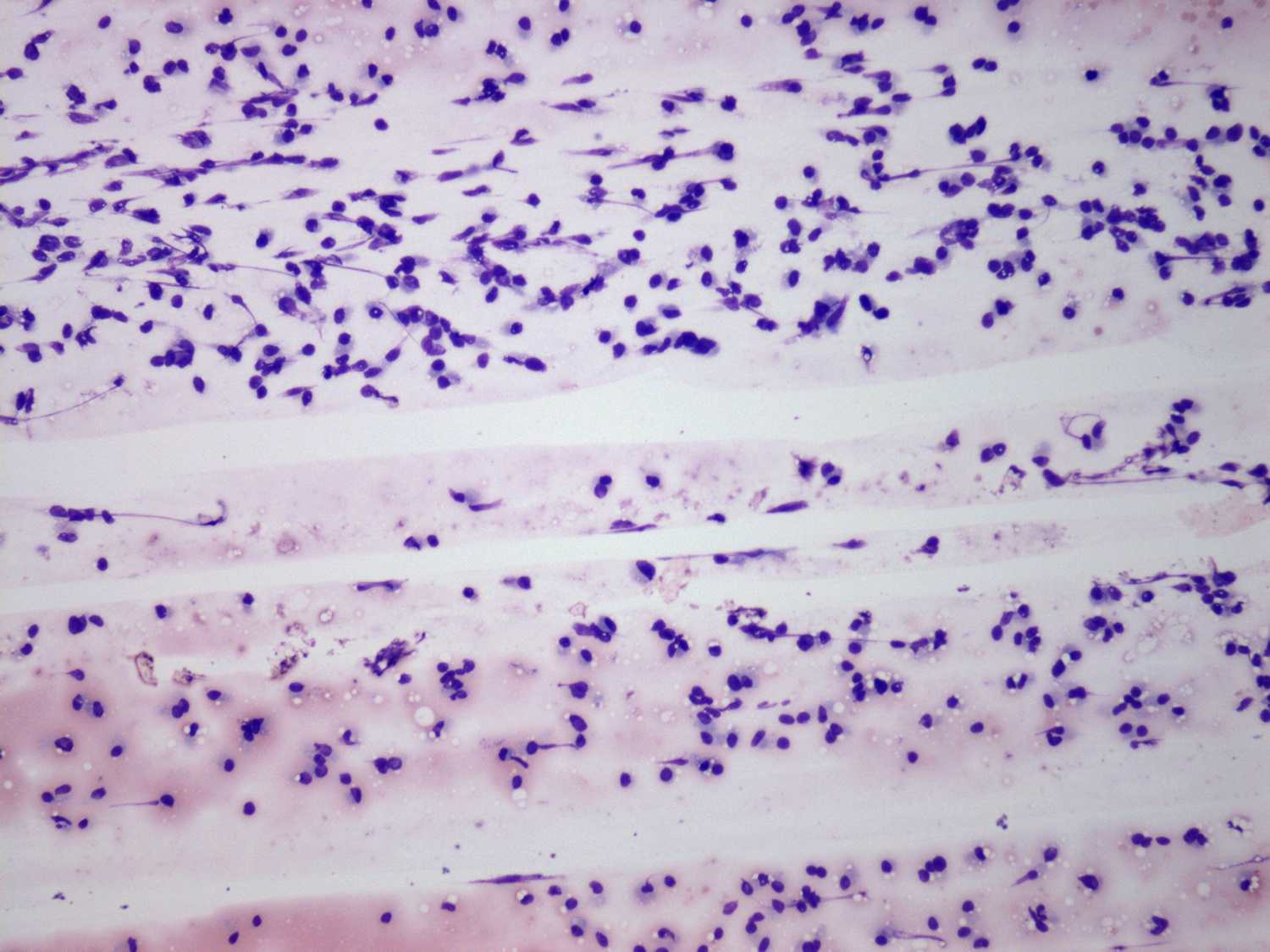 Right lobe, longitudinal scan