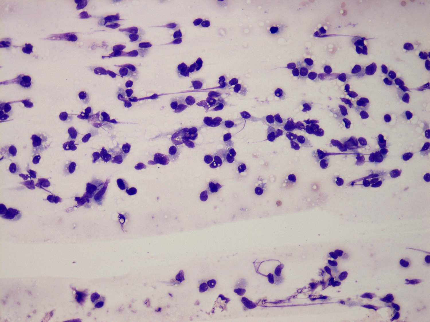 Right lobe, longitudinal scan