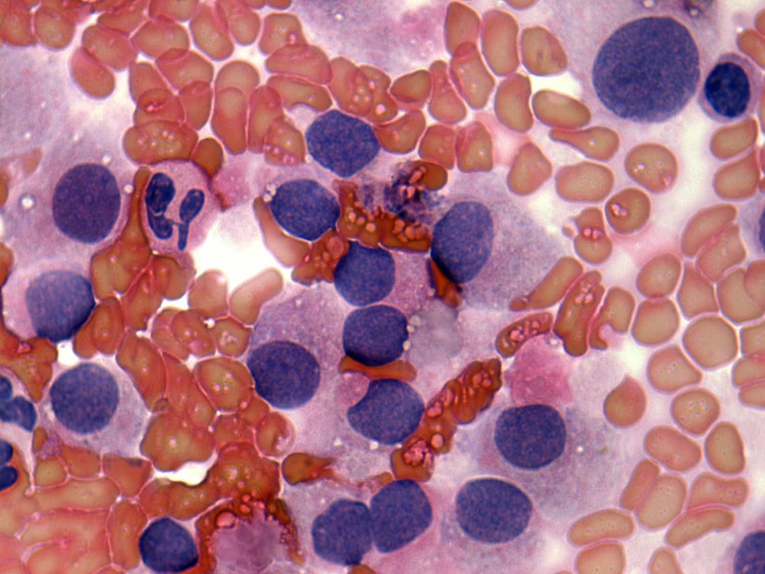 Right lobe, longitudinal scan