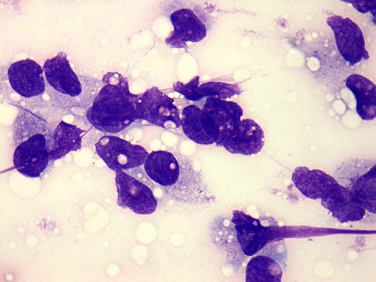 Right lobe, longitudinal scan