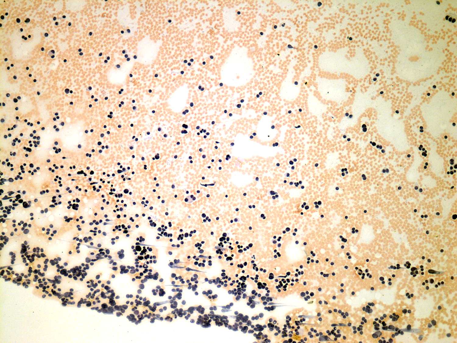 Right lobe, longitudinal scan