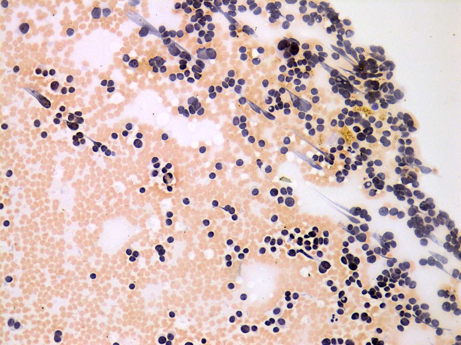 Right lobe, longitudinal scan