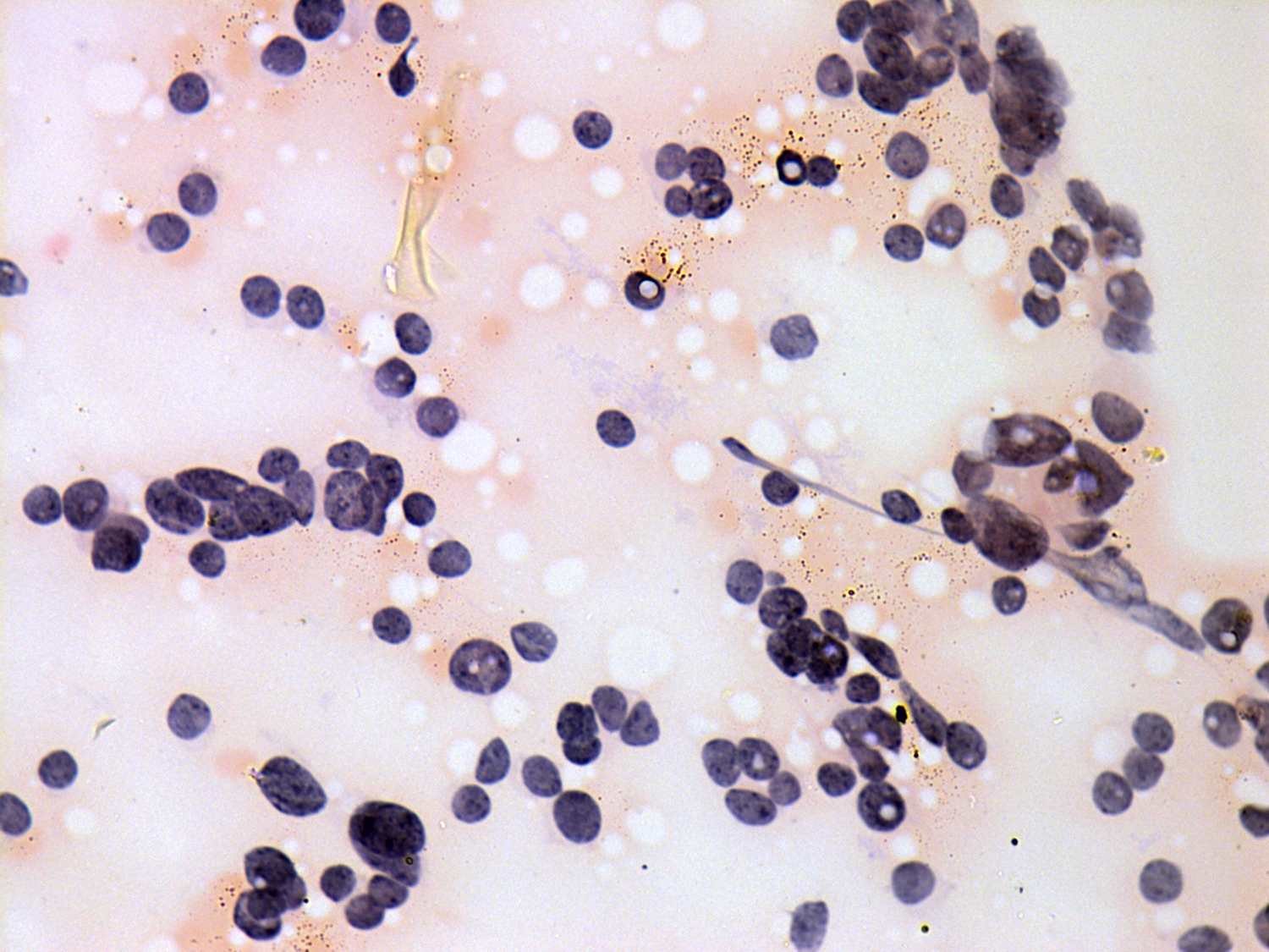 Right lobe, longitudinal scan