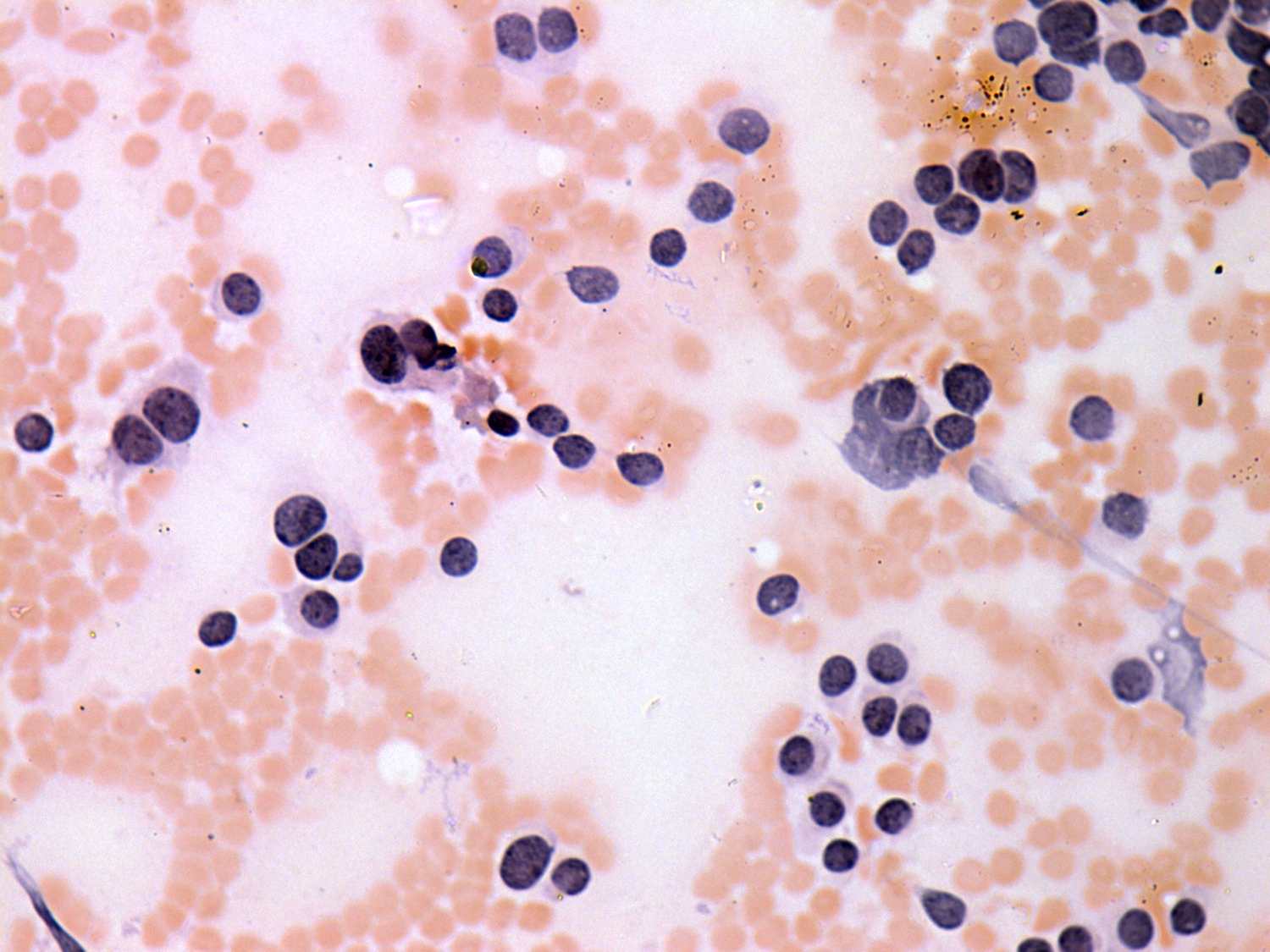 Right lobe, longitudinal scan