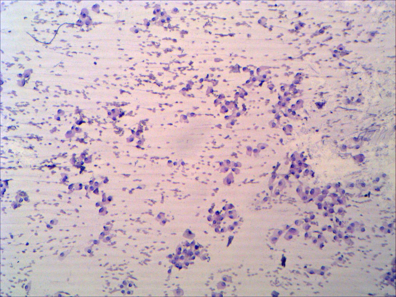 Right lobe, longitudinal scan
