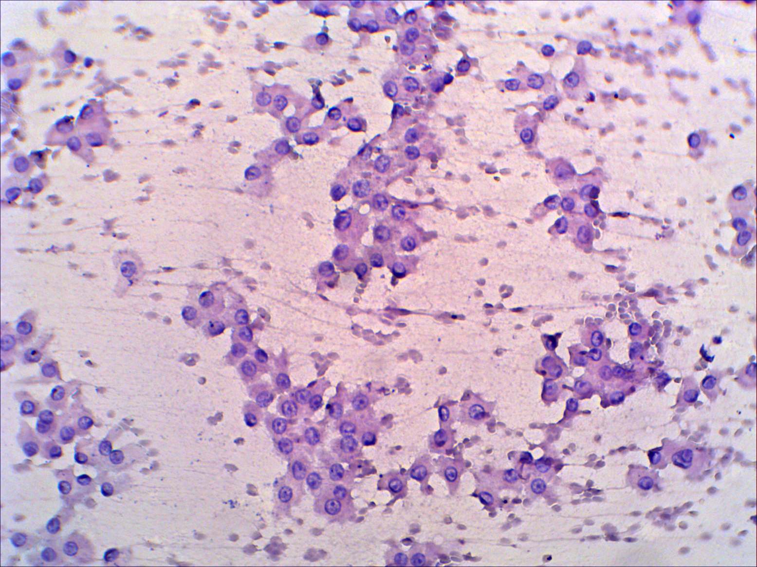 Right lobe, longitudinal scan